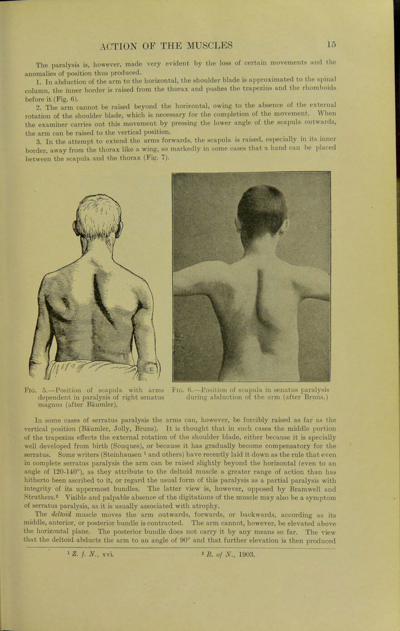 The paralysis is, however, made very evident by the loss of certain movements and the anomalies of position thus produced. 1. In abduction of the arm to the horizontal, the shoulder blade is approximated to the spinal column, the inner border is raised from the thorax and pushes tho trapezius and the rhomboids before it (Fig. 6). 2. The arm cannot be raised beyond the horizontal, owing to the absence of the external rotation of the shoulder blade, which is necessary for the completion of the movement. When the examiner carries out this movement by pressing the lower angle of the scapula outwards, the arm can be raised to the vertical position. 3. In the attempt to extend the arms forwards, the scapula is raised, especially in its inner border, away from the thorax like a wing, so markedly in some cases that a hand can be placed between the scapula and tho thorax (Fig. 7). Fig. 5.—Position of scapula with arms I'u;. (>.—Position of scapula in senatus paralysis dependent in paralysis of right senatus during abduction of the arm (after Bruns.) magnus (after Biiumler). In some cases of serratus paralysis the arms can, however, be forcibly raised as far as the vertical position (Biiumler, Jolly, Bruns). It is thought that in such cases the middle portion of the trapezius effects the external rotation of the shoulder blade, either because it is specially well developed from birth (Souques), or because it has gradually become compensatory for the serratus. Some writers (Steinhausen 1 and others) have recently laid it down as the rule that even in complete serratus paralysis the arm can be raised slightly beyond the horizontal (even to an angle of 120-140°), as they attribute to the deltoid muscle a greater range of action than has hitherto been ascribed to it, or regard the usual form of this paralysis as a partial paralysis with integrity of its uppermost bundles. The latter view is, however, opposed by Bramwell and Struthers.2 Visible and palpable absence of the digitations of the muscle may also be a symptom of serratus paralysis, as it is usually associated with atrophy. The deltoid muscle moves the arm outwards, forwards, or backwards, according as its middle, anterior, or posterior bundle is contracted. The arm cannot, however, be elevated above the horizontal plane. Tho posterior bundle does not carry it by any means so far. The view that the deltoid abducts the arm to an angle of 90° and that further elevation is then produced 1 Z. f. N., xvi. 2 R. oj N., 1903.