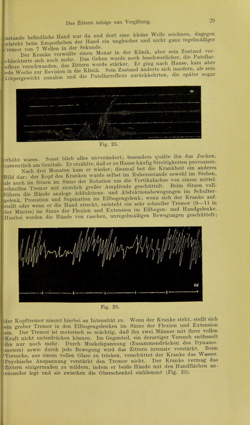 * A„ windliMin Hand nur da und dort eine kleine Welle zeichnen, dagegen SS^S ller Hand ein ungleicher und nicht ganz rcgelmaBiger ^V^aSf^eS Sentonat in dor lUinik aber sein Zustand ver- ohlPohterte s ch noch mohr. Das Gehen WOJfde noch beschwerhcher, die PateUar- eto^cnwandei das Zittern wurde starker. Er ging nach Hause, kam aber efrWooh^ z^Eevkion in die Klinik. Sein Znstand anderte sieh insofern als sein <orprrgewlht zunahm nnd die Patellarreflexe zuriickkehrten, d,e .pater sogar Fig. 25. -rhoht waren Sonst blieb alles unverandert; besonders qualte ihn das Jucken, iamentlich am Genitale. Er erzahlte, daB er zn Hanse haufig Streitigkeiten provoziere. Nach drei Monaten kam er wieder; diesmal bot die Krankheit ein anderes ild dar- der Kopf des Kranken wurde selbst im Rubezustande sowohl lm Stehen, ds auch'im Sitzen im Sinne der Rotation urn die Vertikalachse von einem mittel- chneUen Tremor mit ziemlich groBer Amplitude geschiittelt. Beam Sitzen yoll- ubren die Hande analoge Adduktions- und Abduktionsbewegungen im bchulter- relenk Pronation und Supination im Ellbogengelenk; wenn sich der Kranke auf- BteUt oder wenn er die Hand streckt, entstebt ein sehr schneller Tremor (9—11 in [der Minute) im Sinne der Flexion und Extension im Ellbogen- und Handgelenke. ierbei werden die Hande von raschen, unregelmaBigen Bewegungen geschuttelt; der Kopftremor nimmt hierbei an Intensitat zu. Wenn der Kranke steht, stellt sich ein grober Tremor in den Ellbogengelenken im Sinne der Flexion und Extension ein. Der Tremor ist motorisch so machtig, daB ihn zwei Manner mit ihrer vollen IKraft nicht unterdrucken konnen. Im Gegenteil, ein derartiger Versuch entfesselt ihn nur noch mehr. Durch Muskelspannung (Zusammendriicken des Dynamo- meters) sowie durch jede Bewegung wird das Zittern intensiv verstarkt. Beim Versuche, aus einem vollen Glase zu trinken, verschiittet der Kranke das Wasser. Psychische Anspannung verstarkt den Tremor nicht. Der Kranke vermag das Zittern einigermaBen zu mildern, indem er beido Hande mit den Handflachen an- einander legt und sie zwischen die Oberschenkel einklenimt (Fig. 25).