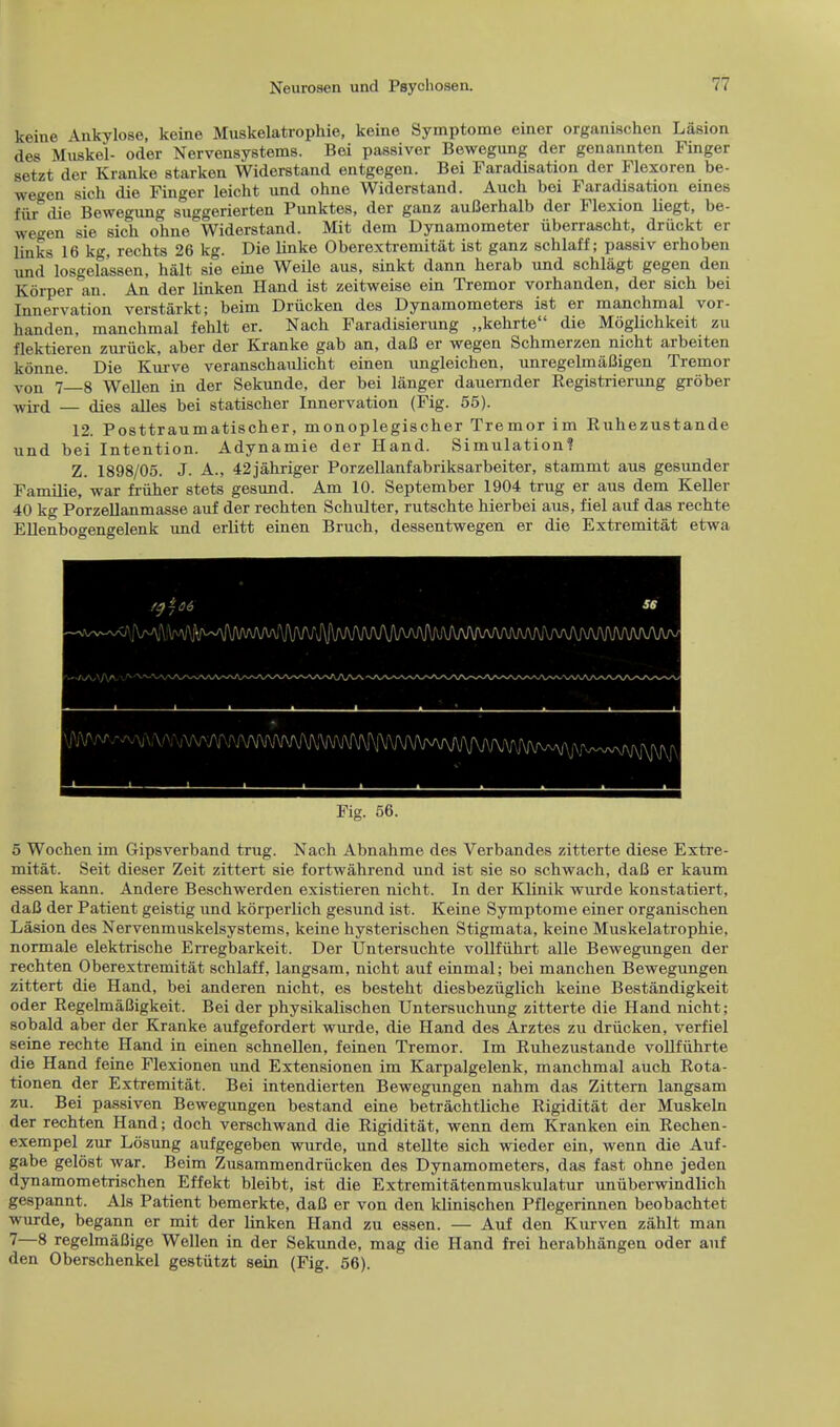 keine Ankylose, keine Muskelatrophie, keine Symptome einer organischen Lasion des Muskel- oder Nervensystems. Boi passiver Bewegung der genannten Finger setzt der Kranke starken Widerstand entgegen. Bei Faradisation der Flexoren be- wegen sich die Finger leicht und ohne Widerstand. Aucb. boi Faradisation eines fur die Bewegung suggerierten Punktes, der ganz auBerhalb der Flexion liegt, be- wegen sie sich ohne Widerstand. Mit dem Dynamometer iiberrascht, driickt er links 16 kg, rechts 26 kg. Die linke Oberextremitiit ist ganz schlaff; passiv erhoben und losgela'ssen, halt sie eine Weile aus, sinkt dann herab und schlagt gegen den Korper an. An der linken Hand ist zeitweise ein Tremor vorhanden, der sich bei Innervation verstarkt; beim Driicken des Dynamometers ist er manchmal vor- handen, manchmal fehlt er. Nach Faradisierung „kehrte die Moglichkeit zu flektieren zuriick, aber der Kranke gab an, daB er wegen Schmerzen nicht arbeiten konne. Die Kurve veranschanlicht einen ungleichen, unregelmiiCigen Tremor von 7_8 Wellen in der Sekunde, der bei langer dauernder Registrierung grtiber wird — dies alles bei statischer Innervation (Fig. 55). 12. Posttraumatischer, monoplegischer Tremor im Ruhezustande und bei Intention. Adynamie der Hand. Simulation? Z. 1898/05. J. A., 42jahriger Porzellanfabriksarbeiter, stammt aus gesunder Familie, war friiher stets gesund. Am 10. September 1904 trug er aus dem Keller 40 kg Porzellanmasse auf der rechten Schulter, rutschte hierbei aus, fiel auf das rechte Ellenbogengelenk und erlitt einen Bruch, dessentwegen er die Extremitat etwa Fig. 56. 5 Wochen im Gipsverband trug. Nach Abnahme des Verbandes zitterte diese Extre- mitat. Seit dieser Zeit zittert sie fortwahrend und ist sie so schwach, daB er kaum essen kann. Andere Beschwerden existieren nicht. In der Klinik wurde konstatiert, daB der Patient geistig und korperlich gesund ist. Keine Symptome einer organischen Lasion des Nervenmuskelsystems, keine hysterischen Stigmata, keine Muskelatrophie, normale elektrische Erregbarkeit. Der Untersuchte vollfiihrt alle Bewegungen der rechten Oberextremitiit schlaff, langsam, nicht auf einmal; bei manchen Bewegungen zittert die Hand, bei anderen nicht, es besteht diesbeziiglich keine Bestandigkeit oder RegelmaBigkeit. Bei der physikalischen Untersuchung zitterte die Hand nicht; sobald aber der Kranke aufgefordert wurde, die Hand des Arztes zu driicken, verfiel seine rechte Hand in einen schnellen, feinen Tremor. Im Ruhezustande vollfiihrte die Hand feine Flexionen und Extensionen im Karpalgelenk, manchmal auch Rota- tionen der Extremitat. Bei intendierten Bewegungen nahm das Zittern langsam zu. Bei passiven Bewegungen bestand eine betrachtliche Rigiditat der Muskeln der rechten Hand; doch verschwand die Rigiditat, wenn dem Kranken ein Rechen- exempel zur Losung aufgegeben wurde, und stellte sich wieder ein, wenn die Auf- gabe gelost war. Beim Zusammendriicken des Dynamometers, das fast ohne jeden dynamometrischen Effekt bleibt, ist die Extremit&tenmuskulatur uniiberwindlich gespannt. Als Patient bemerkte, daB er von den klinischen Pflegerinnen beobachtet wurde, begann er mit der linken Hand zu essen. — Auf den Kurven zahlt man 7—8 regelmaBige Wellen in der Sekunde, mag die Hand frei herabhangen oder auf den Oberschenkel gestiitzt sein (Fig. 56).