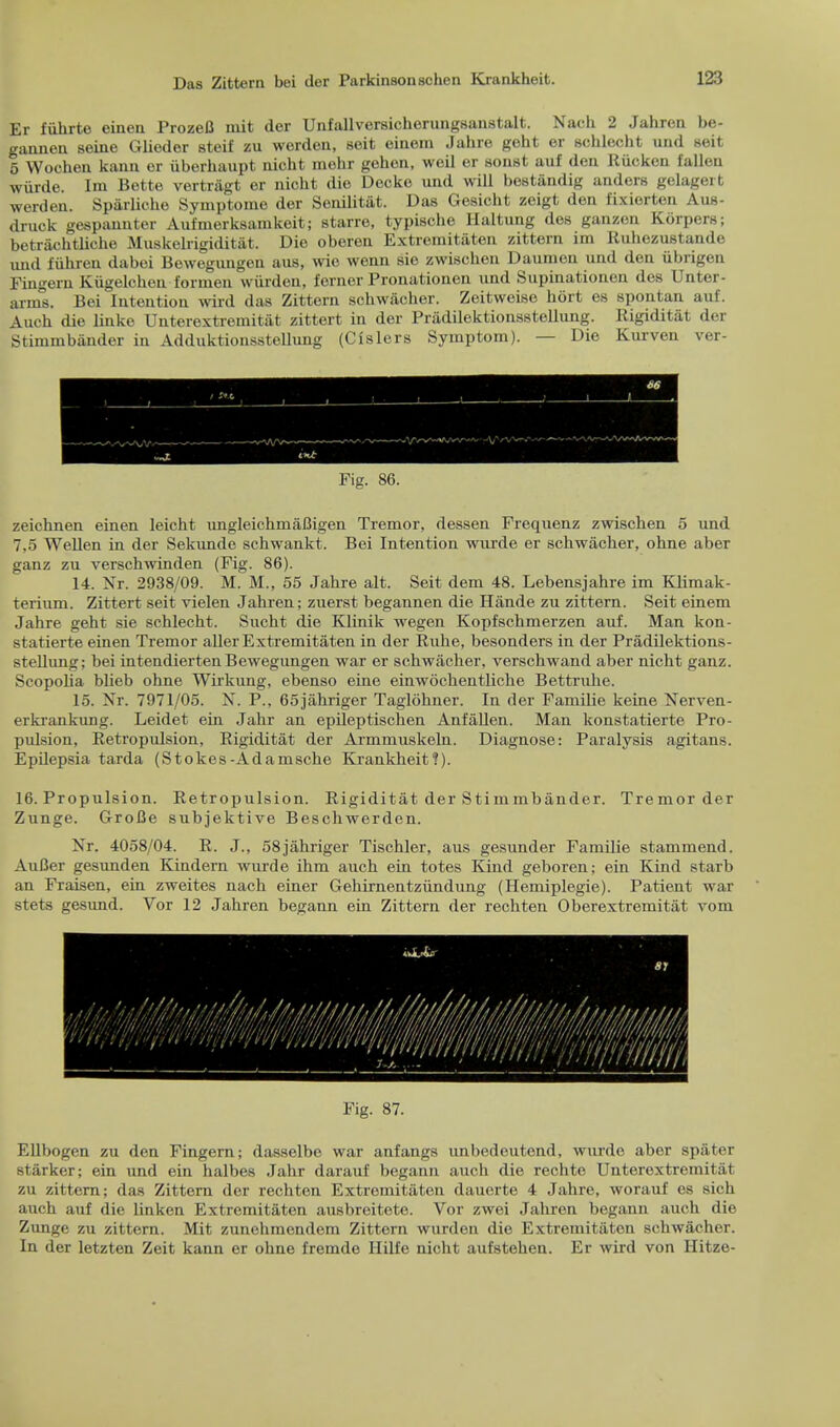 Er fiihrte einen ProzeC mit der Unfallversicherungsanstalt. Nach 2 Jahren be- gannen seine Glieder steif zu worden, soit einem Jahre geht er schlecht und Beit 5 Wochen kann er iiberhaupt nicht mohr gehen, wcil er sonst auf den Riicken fallen wurde. Im Bette vertragt er nicht die Decko und will bestiindig anders gelagert worden. Spaiiiche Symptome der Senilitat. Das Gesieht zeigt den fixiorten Aus- druck gespannter Aufmerksamkeit; starre, typische Haltung des ganzen Korpers; betrachtliche Muskelrigiditiit. Die oberen Extremitiiten zittern im Ruhezustande imd fiihreu dabei Bewegungen aus, wic wenn sic zwischen Daumen und den iibrigen Fingem Kiigelcheu formen wiirden, 1'erner Pronationen und Supinationen des Unter- arms. Bei Intention wird das Zittern schwacher. Zeitweise hort es spontan auf. Auch die linke Unterextremitat zittert in der Priidilektionsstellung. Rigiditat der Stimmbander in Adduktionsstellung (Cislers Symptom). — Die Kurven ver- Fig. 86. zeichnen einen leicht ungleichmaDigen Tremor, dessen Frequenz zwischen 5 und 7,5 Wellen in der Sekunde schwankt. Bei Intention wurde er schwacher, ohne aber ganz zu verschwinden (Fig. 86). 14. Nr. 2938/09. M. M., 55 Jahre alt. Seit dem 48. Lebensjahre im Klimak- terium. Zittert seit vielen Jahren; zuerst begannen die Hande zu zittern. Seit einem Jahre geht sie schlecht. Sucht die Klinik wegen Kopfschmerzen auf. Man kon- statierte einen Tremor aller Extremitiiten in der Ruhe, besonders in der Pradilektions- stellung; bei intendiertenBewegimgen war er schwacher, verschwand aber nicht ganz. Scopolia blieb ohne Wirkung, ebenso eine einwochentliche Bettruhe. 15. Nr. 7971/05. N. P., 65jahriger Taglohner. In der Familie keine Nerven- erkrankung. Leidet ein Jahr an epileptischen Anfalien. Man konstatierte Pro- pulsion, Retropulsion, Rigiditat der Armmuskeln. Diagnose: Paralysis agitans. Epilepsia tarda (Stokes-Adamsche Krankheit?). 16. Propulsion. Retropulsion. Rigiditat der Stimmbander. Tremor der Zunge. GroBe subjektive Beschwerden. Nr. 4058/04. R. J., 58jahriger Tischler, aus gesunder Familie stammend. Aufier gesunden Kindern wurde ihm auch ein totes Kind geboren; ein Kind starb an Fraisen, ein zweites nach einer Gehirnentzundung (Hemiplegie). Patient war stets gesund. Vor 12 Jahren begann ein Zittern der rechten Oberextremitat vom Fig. 87. Ellbogen zu den Fingem; dasselbe war anfangs unbedeutend, wurde aber spiiter starker; ein und ein halbes Jahr darauf begann auch die rechte Unterextremitat zu zittern; das Zittern der rechten Extremitiiten dauerte 4 Jahre, worauf es sich auch auf die linken Extremitaten ausbreitete. Vor zwei Jahren begann auch die Zunge zu zittern. Mit zunehmendem Zittern wurden die Extremitiiten schwacher. In der letzten Zeit kann er ohne fremdo Hilfe nicht aufstehen. Er wird von Hitze-