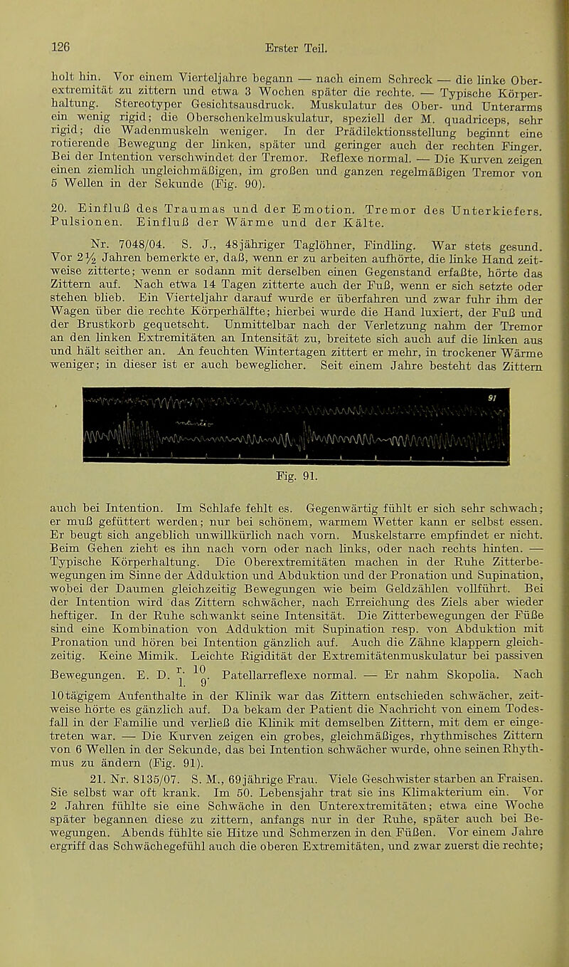 holt hin. Vor einem Vierteljahre begann — nach einem Schreck — die linke Ober- extremitat zu zittern und etwa 3 Wochen spater die rechte. — Typische Kchper- haltung. Stereotyper Gesichtsausdruck. Muskulatur des Ober- und Unterarms ein wenig rigid; die Oberschenkelmuskulatur, speziell der M. quadriceps, sehr rigid; die Wadenmuskeln weniger. In der Pradilektionsstellung beginnt eine rotierende Bewegung der linken, spater und geringer auch der rechten Finger. Bei der Intention verschwindet der Tremor. Reflexe normal. — Die Kurven zeigen einen ziemlich ungleichmaBigen, im groBen und ganzen regelmafligen Tremor von 5 Wellen in der Sekunde (Fig. 90). 20. EinfluB des Traumas und der Emotion. Tremor des Unterkiefers. Pulsionen. EinfluB der Warme und der Kalte. Nr. 7048/04. S. J., 48jahriger Taglohner, Findling. War stets gesund. Vor 2% Jahren bemerkte er, daB, wenn er zu arbeiten aufhorte, die linke Hand zeit- weise zitterte; wenn er sodann mit derselben einen Gegenstand erfaBte, horte das Zittern aui. Nach etwa 14 Tagen zitterte auch der FuB, wenn er sich setzte oder stehen blieb. Ein Vierteljahr darauf wurde er uberfahren und zwar fuhr ihm der Wagen uher die rechte Korperhalf te; hierbei wurde die Hand luxiert, der FuB und der Brustkorb gequetscht. Unmittelbar nach der Verletzung nahm der Tremor an den linken Extremitaten an Intensitat zu, breitete sich auch auf die linken aus und halt seither an. An feuchten Wintertagen zittert er mehr, in trockener Warme weniger; in dieser ist er auch beweglicher. Seit einem Jahre besteht das Zittern 91 m IV: v Fie. 91. auch bei Intention. Im Schlafe fehlt es. Gegenwartig fuhlt er sich sehr schwach; er muB gefuttert werden; nur bei schonem, warmem Wetter kann er selbst essen. Er beugt sich angeblich unwiUkurlick nach vorn. Muskelstarre empfindet er nicht. Beim Gehen zieht es ihn nach vorn oder nach links, oder nach rechts hinten. — Typische Korperhaltung. Die Oberextremitaten machen in der Buhe Zitterbe- wegungen im Sinne der Adduktion und Abduktion und der Pronation und Supination, wobei der Daumen gleichzeitig Bewegungen wie beim Geldzahlen vollfuhrt. Bei der Intention wird das Zittern schwach er, nach Erreichung des Ziels aber wieder heftiger. In der Ruhe schwankt seine Intensitat. Die Zitterbewegungen der FiiBe sind eine Kombination von Adduktion mit Supination resp. von Abduktion mit Pronation und horen bei Intention ganzlich auf. Auch die Zahne klappern gleich- zeitig. Keine Mimik. Leichte Rigiditat der Extremitatenmuskulatur bei passiven Bewegungen. E. D. ^' Patellarreflexe normal. — Er nahm Skopolia. Nach lOtagigem Aufenthalte in der Klinik war das Zittern entschieden schwacher, zeit- weise horte es ganzlich auf. Da bekam der Patient die Nachricht von einem Todes- fall in der Familie und verlieB die Klinik mit demselben Zittern, mit dem er einge- treten war. — Die Kurven zeigen ein grobes, gleichmaBiges, rhythmisches Zittern von 6 Wellen in der Sekunde, das bei Intention schwacher wurde, ohne seinen Rhyth- mus zu andern (Fig. 91). 21. Nr. 8135/07. S. M., 69 jahrige Frau. Viele Geschwister starben an Fraisen. Sie selbst war oft krank. Im 50. Lebensjahr trat sie ins Khmakterium ein. Vor 2 Jahren fiihlte sie eine Schwache in den Unterextremitaten; etwa eine Woche spater begann en diese zu zittern, anfangs nur in der Ruhe, spater auch bei Be- wegungen. Abends fiihlte sie Hitze und Schmerzen in den FiiBen. Vor einem Jahre ergriff das Schwachegefuhl auch die oberen Extremitaten, und zwar zuerst die rechte;