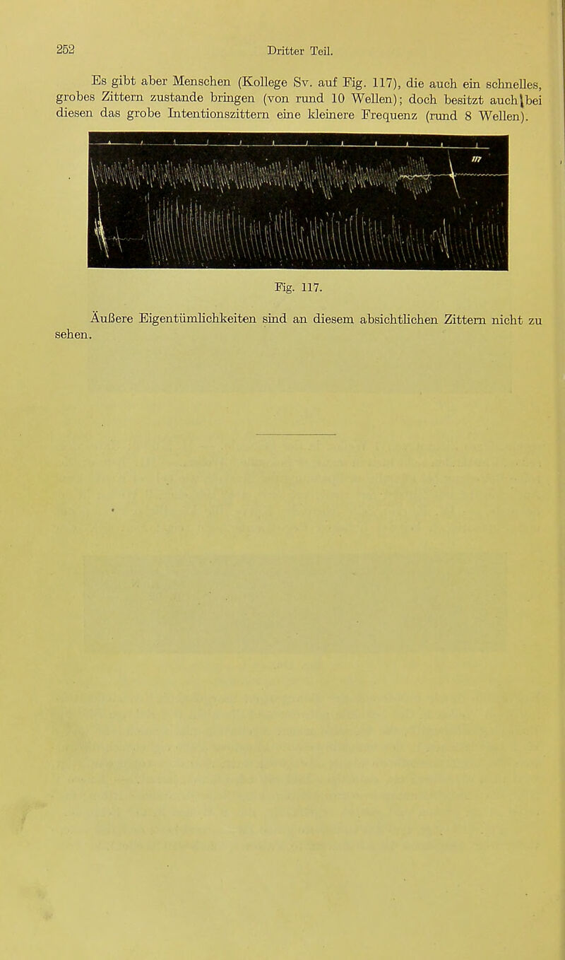 Es gibt aber Menschen (Kollege Sv. auf Fig. 117), die auch ein schnelles, grobes Zittern zustande bringen (von rund 10 Wellen); doch besitzt auch\bei diesen das grobe Intentionszittern eine kleinere Frequenz (rund 8 Wellen). 1 1- - L - .. 1 l i / lii 1 liliii \:, ~*<.-.~zr-—+• ■— seben. Fig. 117. AuBere Eigentiimbchkeiten sind an diesem absicbtHcben Zittern nicht zu