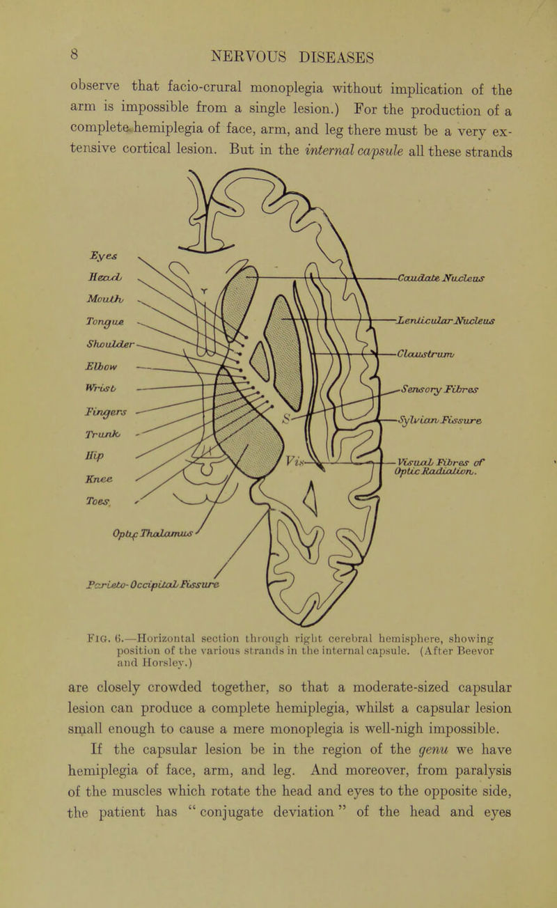 observe that facio-cmral monoplegia mthout implication of the arm is impossible from a single lesion.) For the production of a complete, hemiplegia of face, arm, and leg there must be a very ex- tensive cortical lesion. But in the internal capsule all these strands Fig. 6.—Horizontal section throngh right cerebral hemisphere, showing position of the various strands in the internal capsule. (After Beevor and Horsier.) are closely crowded together, so that a moderate-sized capsular lesion can produce a complete hemiplegia, whilst a capsular lesion sraall enough to cause a mere monoplegia is well-nigh impossible. If the capsular lesion be in the region of the genu we have hemiplegia of face, arm, and leg. And moreover, from paralysis of the muscles which rotate the head and eyes to the opposite side, the patient has  conjugate deviation of the head and eyes