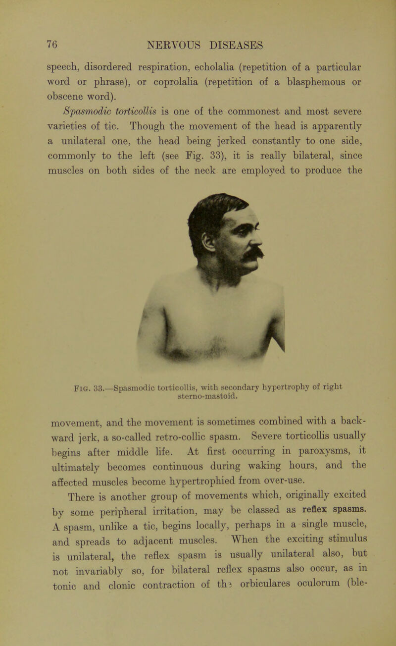 speech, disordered respiration, echolalia (repetition of a particular word or phrase), or coprolalia (repetition of a blasphemous or obscene word). Spasmodic torticollis is one of the commonest and most severe varieties of tic. Though the movement of the head is apparently a unilateral one, the head being jerked constantly to one side, commonly to the left (see Fig. 33), it is really bilateral, since muscles on both sides of the neck are employed to produce the Fig. 33.—Spasmodic torticollis, with secondary hypertrophy of right sterno-ma.stoid. movement, and the movement is sometimes combined with a back- ward jerk, a so-called retro-collic spasm. Severe torticollis usually begins after middle hfe. At first occurring in paroxysms, it ultimately becomes continuous during waking hours, and the affected muscles become hypertrophied from over-use. There is another group of movements which, originally excited by some peripheral irritation, may be classed as reflex spasms. A spasm, unlike a tic, begins locally, perhaps in a single muscle, and spreads to adjacent muscles. When the exciting stimulus is unilateral, the reflex spasm is usually unilateral also, but not invariably so, for bilateral reflex spasms also occur, as in tonic and clonic contraction of th^ orbiculares oculorum (ble-