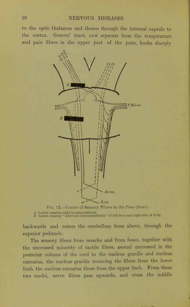 to the optic thalamus and thence through the internal capsule to the cortex. Gowers' tract, now separate from the temperature and pain fibres in the upper part of the pons, hooks sharply backwards and enters the cerebellum from above, through the superior peduncle. The sensory fibres from muscles and from hones, together with the uncrossed minority of tactile fibres, ascend uncrossed in the posterior column of the cord to the nucleus gracilis and nucleus cuneatus, the nucleus gracilis receiving the fibres from the lower limb, the nucleus cuneatus those from the upper limb. From these two nuclei, nerve fibres pass upwards, and cross the middle