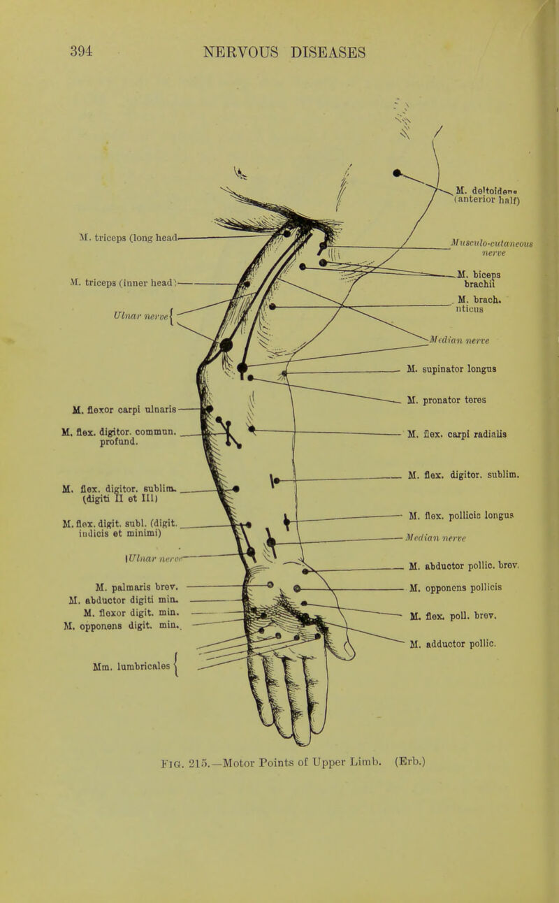 M. deltoideno '(anterior half) yi. triceps (long head- M. triceps (inner head^- Ulnar nerve^' M. flexor carpi ulnaris- M, flex, digitor. commnn. profund. M. flex, digitor. subliro.. ^digiti II et III) M. flex, digit, subl. (digit.. iudicis et minimi) \Ulnar iwrrf M. pal maris brov. M. abductor digiti min. M. flexor digit, min. M. opponens digit, min.. Mm. lurabricales M useulo-mtaneous nerve —M. biceps brachii . M. brach.  nticus n t—: Median neiTe M. supinator longns M. pronator teres M. flex, carpi radi.ilis M. flex, digitor. sublim. M. flex. pollioiE longua Median nerve M. abduotor pollio. brov. M. opponens polllcis M. flex. poll. brev. M. adductor poUic. Fig. 215.—Motor Points of Upper Limb. (Erb.)