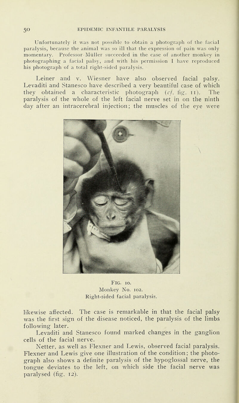 Unfortunately it was not possible to obtain a photograph of the facial paralysis, because the animal was so ill that the expression of pain was only momentary. Professor -Miiller succeeded in the case of another monkey in photographing a facial palsy, and with his permission I have reproduced his photograph of a total right-sided paralysis. Leiner and v. Wiesner have also observed facial palsy. Levaditi and Stanesco have described a very beautiful case of which they obtained a characteristic photograph (cf. fig. n). The paralysis of the whole of the left facial nerve set in on the ninth day after an intracerebral injection; the muscles of the eye were Fig. io. Monkey No. 102. Right-sided facial paralysis. likewise affected. The case is remarkable in that the facial palsy was the first sign of the disease noticed, the paralysis of the limbs following later. Levaditi and Stanesco found marked changes in the ganglion cells of the facial nerve. Netter, as well as Flexner and Lewis, observed facial paralysis. Flexner and Lewis give one illustration of the condition; the photo- graph also shows a definite paralysis of the hypoglossal nerve, the tongue deviates to the left, on which side the facial nerve was paralysed (fig. 12).