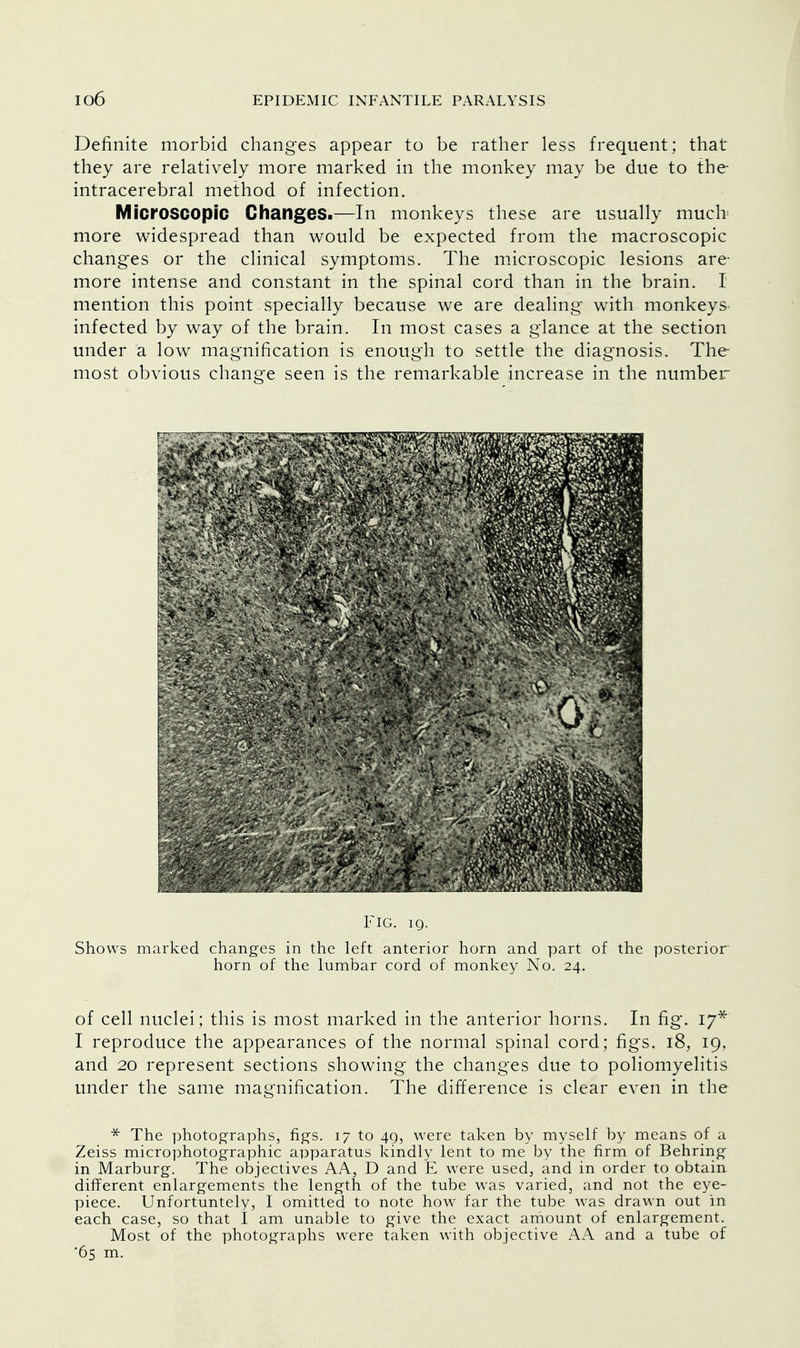 Definite morbid changes appear to be rather less frequent; that they are relatively more marked in the monkey may be due to the intracerebral method of infection. Microscopic Changes.—In monkeys these are usually much more widespread than would be expected from the macroscopic changes or the clinical symptoms. The microscopic lesions are- more intense and constant in the spinal cord than in the brain. I mention this point specially because we are dealing with monkeys- infected by way of the brain. In most cases a glance at the section under a low magnification is enough to settle the diagnosis. The most obvious change seen is the remarkable increase in the number Fig. 19. Shows marked changes in the left anterior horn and part of the posterior horn of the lumbar cord of monkey No. 24. of cell nuclei; this is most marked in the anterior horns. In fig. 17* I reproduce the appearances of the normal spinal cord; figs. 18, 19. and 20 represent sections showing the changes due to poliomyelitis under the same magnification. The difference is clear even in the * The photographs, figs. 17 to 49, were taken by myself by means of a Zeiss microphotographic apparatus kindly lent to me by the firm of Behring in Marburg. The objectives AA3 D and E were used, and in order to obtain different enlargements the length of the tube was varied, and not the eye- piece. Unfortuntely, I omitted to note how far the tube was drawn out in each case, so that I am unable to give the exact amount of enlargement. Most of the photographs were taken with objective AA and a tube of 65 m.