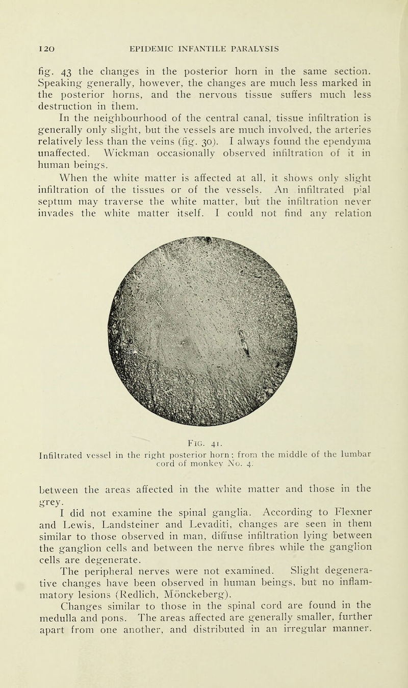 fig. 43 the changes in the posterior horn in the same section. Speaking generally, however, the changes are much less marked in the posterior horns, and the nervous tissue suffers much less destruction in them. In the neighbourhood of the central canal, tissue infiltration is generally only slight, but the vessels are much involved, the arteries relatively less than the veins (fig. 30). I always found the ependyma unaffected. Wickman occasionally observed infiltration of it in human beings. When the white matter is affected at all, it shows only slight infiltration of the tissues or of the vessels. An infiltrated pial septum may traverse the white matter, but the infiltration never invades the white matter itself. I could not find any relation Fig. 41. Infiltrated vessel in the ri^ht posterior horn: from the middle of the lumbar cord of monkey No. 4. between the areas affected in the white matter and those in the grey. I did not examine the spinal ganglia. According to hlexner and Lewis, Landsteiner and Levaditi, changes are seen in them similar to those observed in man, diffuse infiltration lying between the ganglion cells and between the nerve fibres while the ganglion cells are degenerate. The peripheral nerves were not examined. Slight degenera- tive changes have been observed in human beings, but no inflam- matory lesions (Redlich, Monckeberg). Changes similar to those in the spinal cord are found in the medulla and pons. The areas affected are generally smaller, further apart from one another, and distributed in an irregular manner.