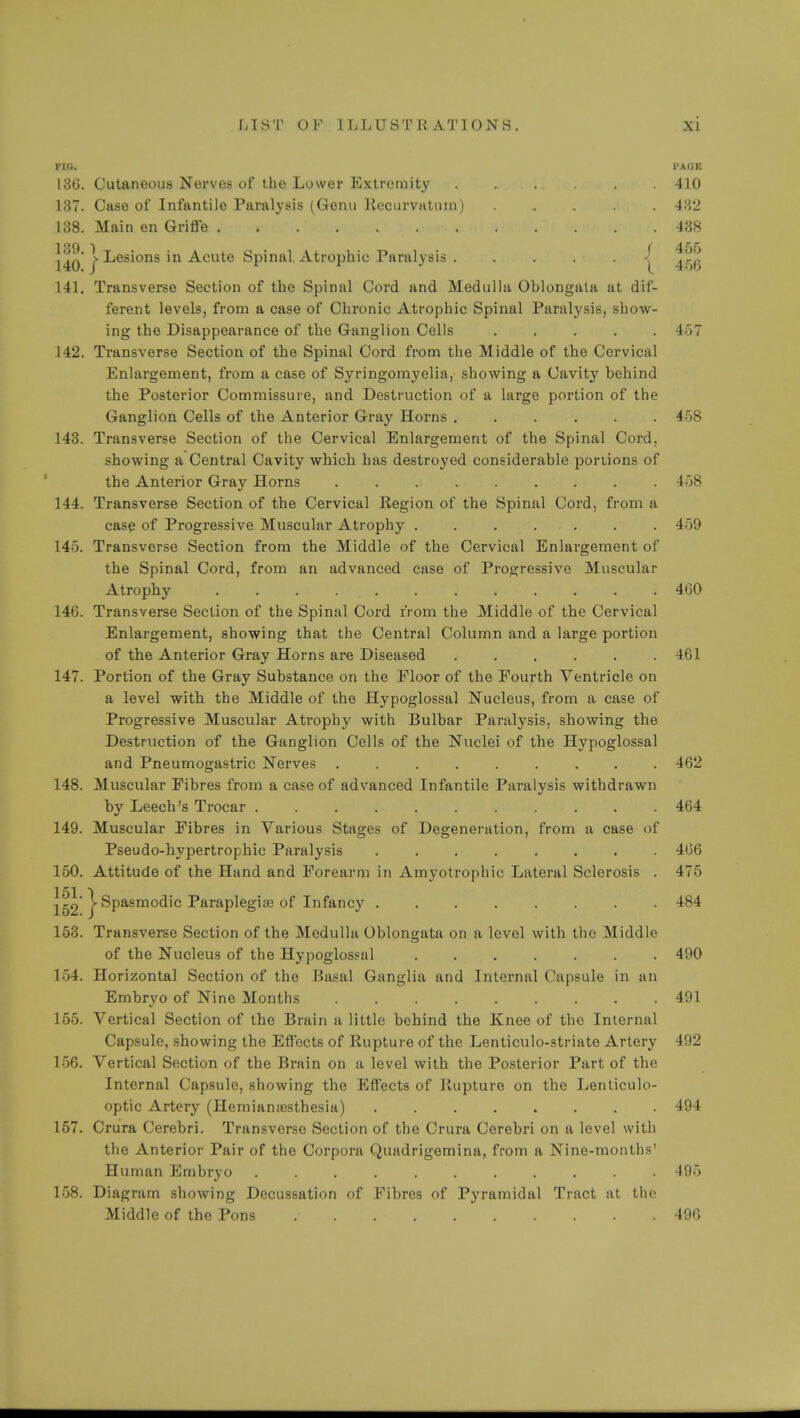 YUS. I'AOK 130. Cutaneous Nerves of the Lower Extremity 410 137. Case of Infantile Paralysis (Genu Recurvatum) 432 138. Main en Griffe 438 | Lesions in Acute Spinal Atrophic Paralysis -| ^! 141. Transverse Section of the Spinal Cord and Medulla Oblongata at dif- ferent levels, from a case of Chronic Atrophic Spinal Paralysis, show- ing the Disappearance of the Ganglion Cells 457 142. Transverse Section of the Spinal Cord from the Middle of the Cervical Enlargement, from a case of Syringomyelia, showing a Cavity behind the Posterior Commissure, and Destruction of a large portion of the Ganglion Cells of the Anterior Gray Horns ...... 458 143. Transverse Section of the Cervical Enlargement of the Spinal Cord, showing a Central Cavity which has destroyed considerable portions of the Anterior Gray Horns 458 144. Transverse Section of the Cervical Region of the Spinal Cord, from a case of Progressive Muscular Atrophy . . . . . . . 459 145. Transverse Section from the Middle of the Cervical Enlargement of the Spinal Cord, from an advanced case of Progressive Muscular Atrophy . . . . . 4C0 146. Transverse Section of the Spinal Cord from the Middle of the Cervical Enlargement, showing that the Central Column and a large portion of the Anterior Gray Horns are Diseased ...... 461 147. Portion of the Gray Substance on the Floor of the Fourth Ventricle on a level with the Middle of the Hypoglossal Nucleus, from a case of Progressive Muscular Atrophy with Bulbar Paralysis, showing the Destruction of the Ganglion Cells of the Nuclei of the Hypoglossal and Pneumogastric Nerves ......... 462 148. Muscular Fibres from a case of advanced Infantile Paralysis withdrawn by Leech's Trocar . . . . . . . . . . . 464 149. Muscular Fibres in Various Stages of Degeneration, from a case of Pseudo-hypertrophic Paralysis ........ 406 150. Attitude of the Hand and Forearm in Amyotrophic Lateral Sclerosis . 475 151 1 152 ( Spasmodic Paraplegias of Infancy ........ 484 153. Transverse Section of the Medulla Oblongata on a level with the Middle of the Nucleus of the Hypoglossal ....... 490 154. Horizontal Section of the Basal Ganglia and Internal Capsule in an Embryo of Nine Months ......... 491 155. Vertical Section of the Brain a little behind the Knee of the Internal Capsule, showing the Effects of Rupture of the Lenticulo-striate Artery 492 156. Vertical Section of the Brain on a level with the Posterior Part of the Internal Capsule, showing the Effects of Rupture on the Lenticulo- optic Artery (Hemianajsthesia) 494 157. Crura Cerebri. Transverse Section of the Crura Cerebri on a level with the Anterior Pair of the Corpora Quadrigemina, from a Nine-months' Human Embryo 495 158. Diagram showing Decussation of Fibres of Pyramidal Tract at the Middle of the Pons 490