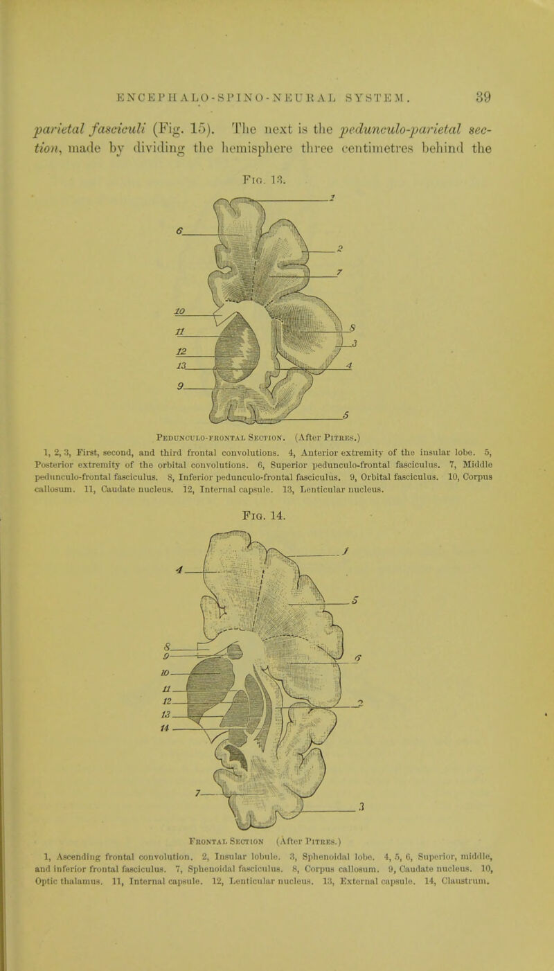 K N'C K 1' U A LO-SIM NO- X K L \i A L SYSTK M . :;it parietal fasciculi (Fig. 15). The next is the pedunculo-parietal sec- tion, made by dividing the hemisphere three centimetres behind the Fin. 18. 10 n 9 Peduncvi.o-fkontal Section. (After Pitkes.) 1, 2, 3, First, second, and third frontal convolutions. 4, Anterior extremity of the insular lobe. 5, Posterior extremity of the orbital convolutions. 6, Superior pedunculo-frontal fasciculus. 7, Middle pediinculo-frontal fasciculus. 8, Inferior pedunculo-frontal fasciculus. 9, Orbital fasciculus. 10, Corpus caUosnm. 11, Caudate nucleus. 12, Internal capsule. 13, Lenticular nucleus. Fig. 14. Frontal Suction (After 1'itres.) 1, Ascending frontal convolution. 2, Insular lobule. 3, Sphenoidal lobo. 4, 5, 6, Superior, middle, and inferior frontal fasciculus. 7, Sphenoidal fasciculus. 8, Corpus callosum. 9, Caudate nucleus. 10,