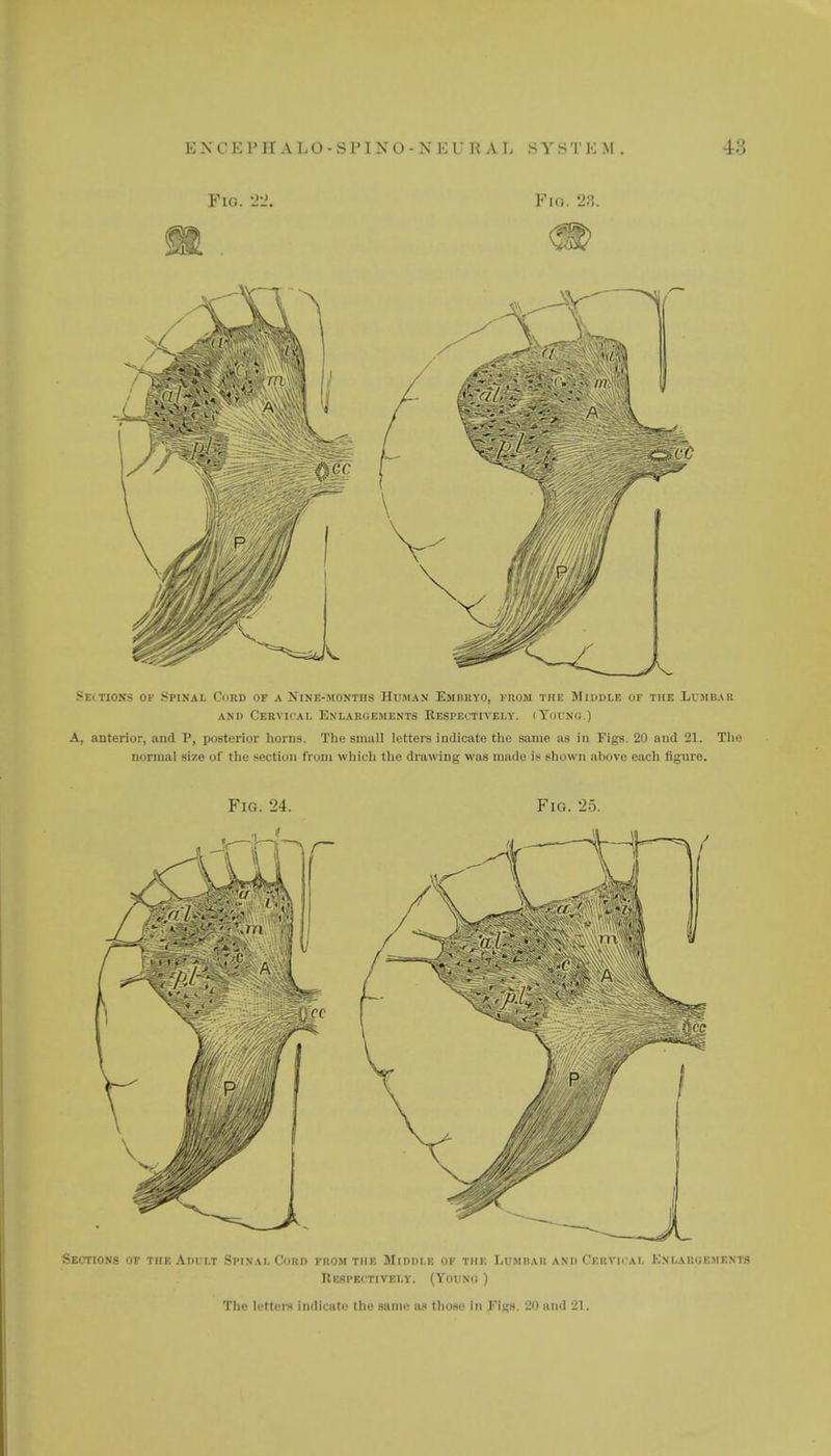 ENCKIMTALO-SPIXO-N K l UAL SYSTEM Fig. 22, Pio. 28. >ei tions of Spinal Curd of a Nine-months Human Embryo, from the Middle of the Lumbar and Cervical Enlargements Respectively, i Young.) A, anterior, and P, posterior horns. The small letters indicate the same as in Figs. 20 and 21. The normal size of the section from which the drawing was made is shown above each figure. Fig. 24. Fig. 25. Sections of the Adult Spinal Cord from the Middle of the Lumbar and Cervical Knlargkmf.ms Respectively. (Young ) The letters indicate the same as those in Figs. 20 and 21.