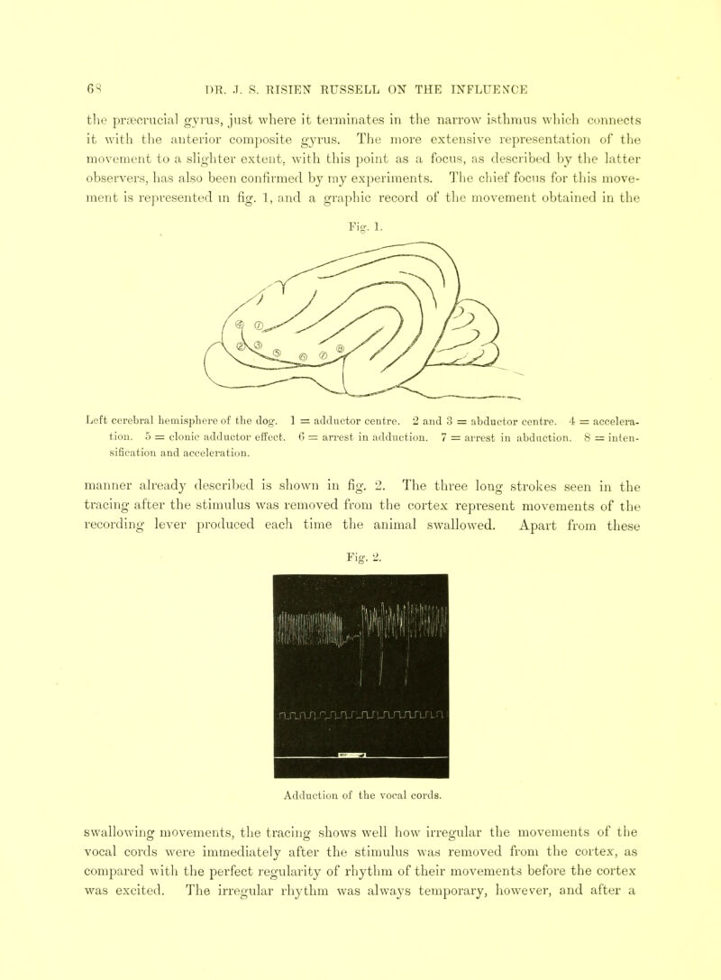 the prsecrucial gyrus, just where it terminates in the narrow isthmus which connects it with the anterior composite gyrus. The more extensive representation of the movement to a slighter extent, with this point as a focus, as described by the latter observers, has also been confirmed by my experiments. The chief focus for this move- ment is represented in fig. 1, and a graphic record of the movement obtained in the Fig. 1. Left cerebral hemisphere of the dog. 1 — adductor centre. 2 and 3 — abductor centre. 4 = accelera- tion. 5 = clonic adductor effect. 6 = arrest in adduction. 7 = arrest in abduction. 8 = inten- sification and acceleration. manner already described is shown in fig. 2. The three long strokes seen in the tracing after the stimulus was removed from the cortex represent movements of the recording lever produced each time the animal swallowed. Apart from these Fig. 2. sfjuvn rjjyv _tlt\juXnr\j Adduction of the vocal cords. swallowing movements, the tracing shows well how irregular the movements of the vocal cords were immediately after the stimulus was removed from the cortex, as compared with the perfect regularity of rhythm of their movements before the cortex was excited. The irregular rhythm was always temporary, however, and after a