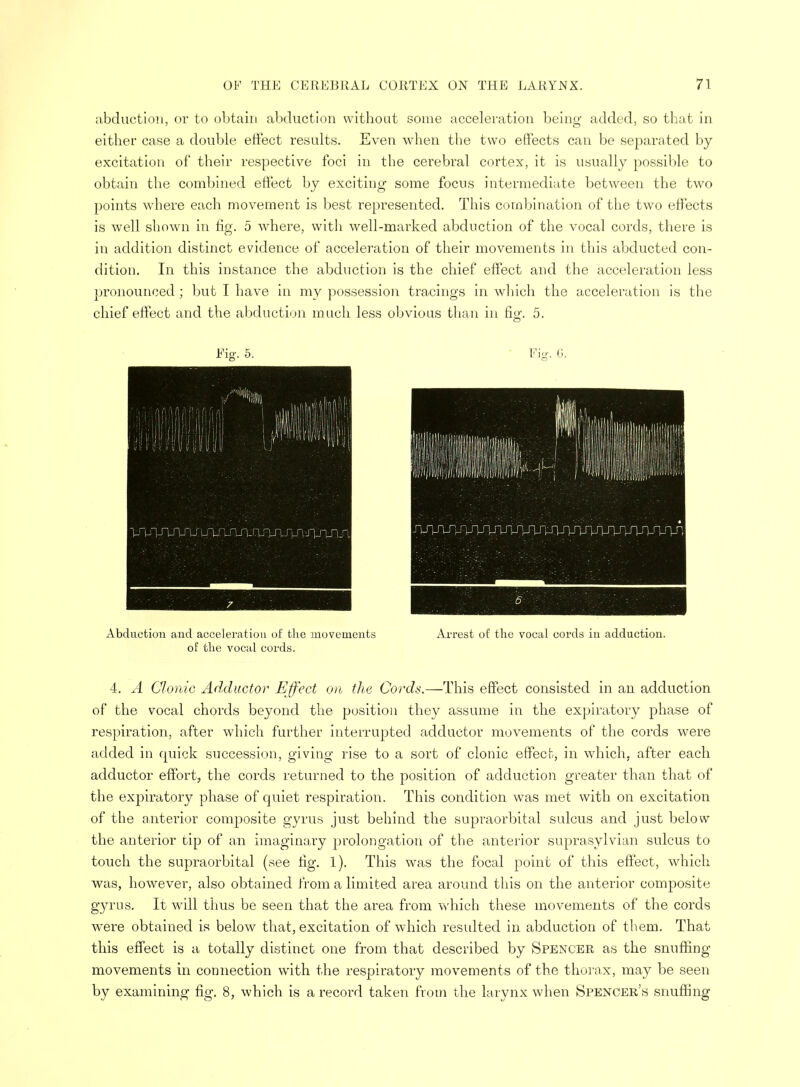 abduction, or to obtain abduction without some acceleration being- added, so that in either case a double effect results. Even when the two effects can be separated by- excitation of their respective foci in the cerebral cortex, it is usually possible to obtain the combined effect by exciting some focus intermediate between the two points where each movement is best represented. This combination of the two effects is well shown in fig. 5 where, with well-marked abduction of the vocal cords, there is in addition distinct evidence of acceleration of their movements in this abducted con- dition. In this instance the abduction is the chief effect and the acceleration less pronounced; but I have in my possession tracings in which the acceleration is the chief effect and the abduction much less obvious than in fifif. 5. Fig. 5. Fig. G. Abduction and acceleration of the movements Arrest of the vocal cords in adduction, of the vocal cords. 4. A Clonic Adductor Effect on the Cords.—This effect consisted in an adduction of the vocal chords beyond the position they assume in the expiratory phase of respiration, after which further interrupted adductor movements of the cords were added in quick succession, giving rise to a sort of clonic effect, in which, after each adductor effort, the cords returned to the position of adduction greater than that of the expiratory phase of quiet respiration. This condition was met with on excitation of the anterior composite gyrus just behind the supraorbital sulcus and just below the anterior tip of an imaginary prolongation of the anterior suprasylvian sulcus to touch the supraorbital (see tig. 1). This was the focal point of this effect, which was, however, also obtained from a limited area around this on the anterior composite gyrus. It will thus be seen that the area from which these movements of the cords were obtained is below that, excitation of which resulted in abduction of them. That this effect is a totally distinct one from that described by Spencer as the snuffing movements in connection with the respiratory movements of the thorax, may be seen by examining fig. 8, which is a record taken from the larynx when Spencer's snuffing