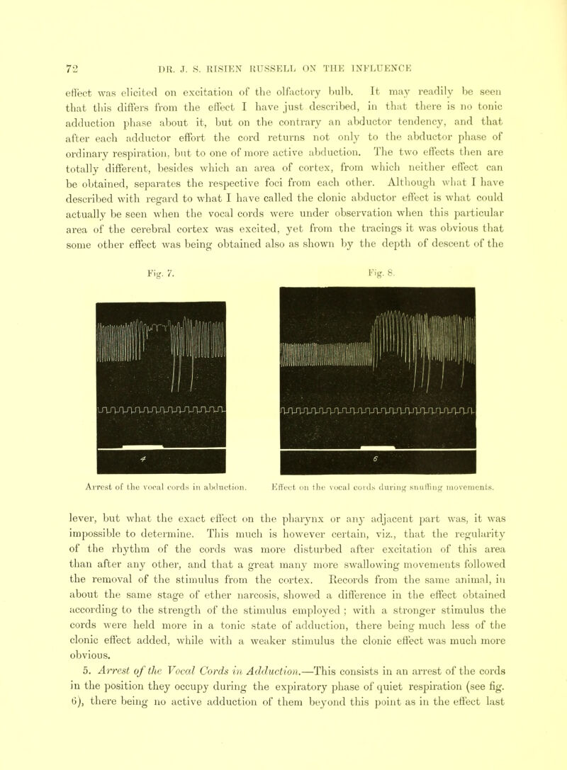 effect was elicited on excitation of the olfactory bulb. It may readily be seen that this differs from the effect I have just described, in that there is no tonic adduction phase about it, but on the contrary an abductor tendency, and that after each adductor effort the cord returns not only to the abductor phase of ordinary respiration, but to one of more active abduction. The two effects then are totally different, besides which an area of cortex, from which neither effect can be obtained, separates the respective foci from each other. Although what I have described with regard to what I have called the clonic abductor effect is what could actually be seen when the vocal cords were under observation when this particular area of the cerebral cortex was excited, yet from the tracings it was obvious that some other effect was being obtained also as shown by the depth of descent of the lever, but what the exact effect on the pharynx or any adjacent part was, it was impossible to determine. This much is however certain, viz., that the regularity of the rhythm of the cords was more disturbed after excitation of this area than after any other, and that a great many more swallowing movements followed the removal of the stimulus from the cortex. Records from the same animal, in about the same stage of ether narcosis, showed a difference in the effect obtained according to the strength of the stimulus employed ; with a stronger stimulus the cords were held more in a tonic state of adduction, there being much less of the clonic effect added, while with a weaker stimulus the clonic effect was much more obvious. 5. Arrest of the Vocal Cords in Adduction.—This consists in an arrest of the cords in the position they occupy during the expiratory phase of quiet respiration (see fig. 6), there being no active adduction of them beyond this point as in the effect last