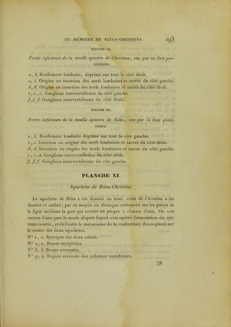 FIGURE II. Partic infcrieure do la nioelle epiniere de Christina, vuc par sa face pos- terieure. a, b. Renflement lombaire, deprime sur tout le cote droit. c, c. Origine ou insertion des nerfs lombaires et sacres du cote gauche. . d. Origine ou insertion des nerfs lombaires et sacres du c6te droit, e, e, e. Ganglions intervertebraux du cote gauche. f-,_fi f. Ganglions intervertebraux du cote droit. FIGURE III. Partie injerieure de la moelle epiniere de Ritta, vuc par la face poste- rieure. a, l>. Renflement lombaire deprime sur tout le cote gauche. c, c. Insertion ou origine des nerfs lombaires et sacres du cote droit. d, d. Insertion ou origine des nerfs lombaires et sacres du cote gauche. e , e , e. Ganglions intervertebraux du cote droit. /, /, f. Ganglions intervertebraux du cote gauche. PLANCHE XI. Squelelte de Ritta-Christina Le squelette de Ritta a ete dessine au trait, celui de Christina a ete dessine et ombre; par ce moyen on distingue nettement sur les pieces de la ligne mediane la part qui revient en propre a chacun d'eux. On voit encore d'une part le mode d'apres Icquel s'est operee I'association du sys- teme osseux , et de I'autre le mecanisme de la coalescence des os places sur le centre des deux squelettes. N°' I, I. Synciput des deux cranes. N 2, 2. Bosses occipitales. N°' 3, 3. Bosses coronates. N' 9, g. Region cervicale des colonnes verlebrales. 38