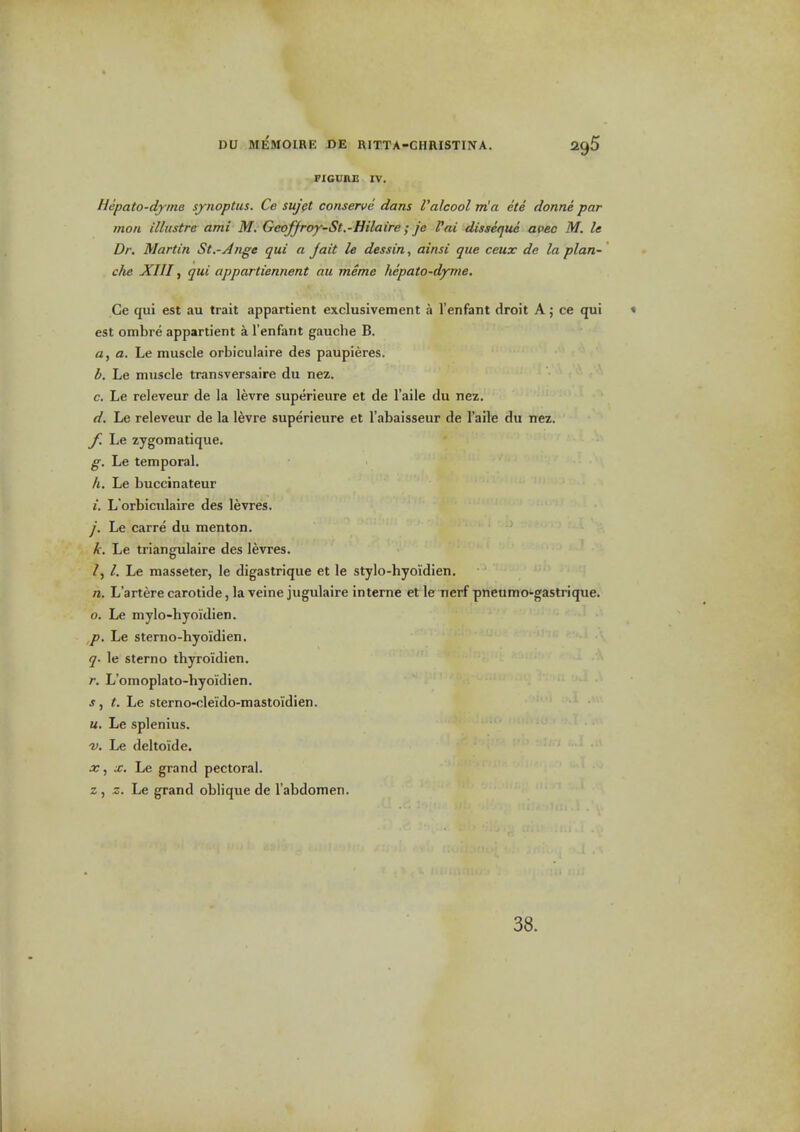 FIGURE IV. Hepato-dyine synoptus. Co suj$t conserve dans Valcool m'a ete donne par mon illiistre ami M. Geoffroy-St.-Hilaire; je I'ai disseejue acec M. le Dr. Martin St.-Ange qui a J ait le dessin, ainsi que ceux de la plan- che XIII, qui appartiennent au mime hepato-dyme. Ce qui est au trait appartient exclusivement a 1'enfant droit A; ce qui est ombre appartient a I'enfant gauche B. a, a. Le muscle orbiculaire des paupieres. b. Le muscle transversaire du nez. c, Le releveur de la levre superieure et de I'aile du nez. d. Le releveur de la levre superieure et I'abaisseur de I'aile du nez, f. Le zygomatique. g. Le temporal. h. Le buccinateur I. L'orbicnlaire des levres. j. Le carre du menton. k. Le triangulaire des levres. /, Le masseter, le digastrique et le stylo-hyoidien. n. L'artere carotide, la veine jugulaire interne etle nerf pneumo-gastrique. o. Le mylo-hyoi'dien. p. Le sterno-hyoidien. q- le sterno thyroidien. r. L'omoplato-hyoidien. s, t. Le sterno-cleido-mastoidien. u. Le splenius. -f. Le deltoide. Xw. Le grand pectoral. z , z. Le grand oblique de I'abdomen. 38.