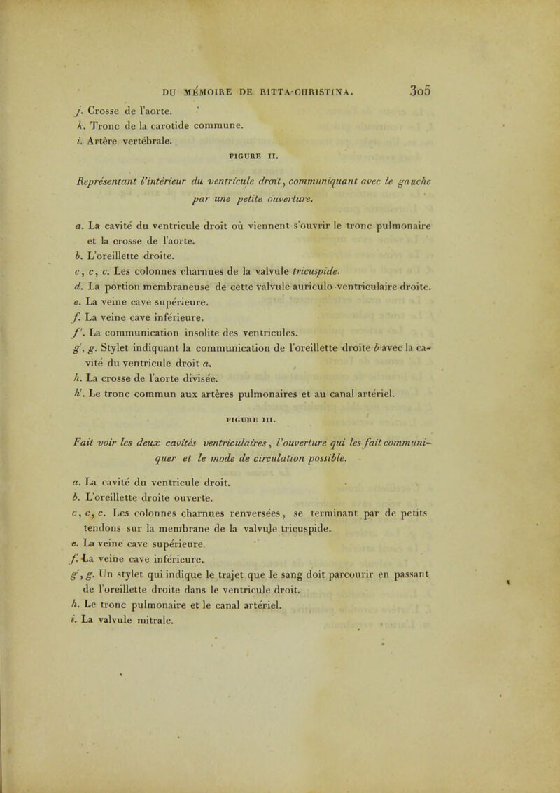 j. Crosse de Taorte. k. Troiic de la carotide commune. i. Artere vertebrale. FIGURE II. Representant I'interieur dii ventricule droit, communiquant afec le gauche par une petite oiwerture. a. La cavite du ventricule droit ou viennent s'ouvrir le tronc pulmonaire et la crosse de I'aorte. b. L'oreillelte droite. c. c, c. Les colonnes charnues de la valvule tricuspide. d. La portion membraneuse de cette valvule auriculo ventriculaire droite. e. La veine cave superieure. /. La veine cave inferieure. y. La communication insolite des ventricules. g', g. Stylet indiquant la communication de I'oreillette droite b avec la ca- vite du ventricule droit a. h. La crosse de i'aorte divisee. h'. Le tronc commun aux arteres pulmonaires et au canal arteriel. FIGURE III. Fait voir les deux cavites ventriculaires, Vouverture qui les fait communi- quer et le mode de circulation possible, a. La cavite du ventricule droit. b. L'oreillette droite ouverte. c. c,c. Les colonnes charnues renversees, se terminant par de petits tendons sur la membrane de la valvuje tricuspide. e. La veine cave superieure -La veine cave inferieure. ^, g. Un stylet quiindique le trajet que le sang doit parcourir en passant de l'oreillette droite dans le ventricule droit. h. Le tronc pulmonaire et le canal arteriel. I. La valvule mitrale.