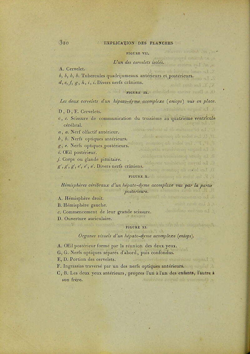 FIGUnE VII. L'un des cervelets isales, A. Cervelet. b, 5, Tubercules quadrijumeaux anterieurs et posterieurs. d, e,J, /i, ^■, i. Divers nerfs crS.niens. PIGTIRE IX. Les deux ceruelets d'un hepaiq-;(I^m.e^acotnplexe (^eniops) vus en place, D , D , E. Gervelets. c, c. Scissure de communication du troisienie au quatrieme ventncale cerebral. a, a. Nerf olfactif anterieur. b, h. Nerfs optiques anterieurs. e. Nerfs optiques,posterieurs. i. OEil posterieur. j. Corps ou glande pituitaire. g'l g, g, e', e', e'. Divers-nerfs cr^ens. FIGURE. X. Hemispheres cerebraux d'un hepato-djme acomplexe vus par la parlie ' ' posterieure. A. Hemisphere droit. B. Hemisphere gauche. c, Commencement de leur grande scissure. D. Ouverture auriculaire. tiGURl; XI. Organes visuals d'un hepato-dyme acomplexe {eniops)t A. OEil posterieur forme par la reunion, des deux yeux, G, G. Nerfs optiques separes d'abord, puis confondus. E. D. Portion des cervelets. F. Ingrassias traverse par un des nerfs optiques anterieurs. C. B. Les deux yeux anterieurs, propres l'un a l'un des enfants, I'autre i son frfire.