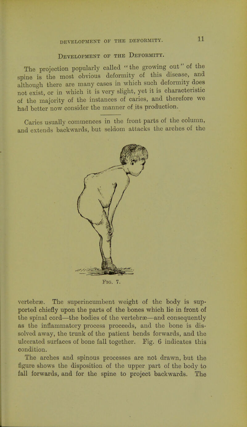 DEVELOPMENT OF THE DEFOEMITY. Development op the Deformity. The projection popularly called the growing out of the spine is the most obvious deformity of this disease, and although there are many cases in which such deformity does not exist, or in which it is very slight, yet it is characteristic of the majority of the instances of caries, and therefore we had better now consider the manner of its production. Caries usually commences in the front parts of the column, and extends backwards, but seldom attacks the arches of the Fig. 7. vertebrae. The superincumbent weight of the body is sup- ported chiefly upon the parts of the bones which lie in front of the spinal cord—the bodies of the vertebrae—and consequently as the inflammatory process proceeds, and the bone is dis- solved away, the trunk of the patient bends forwards, and the ulcerated surfaces of bone fall together. Fig. 6 indicates this condition. The arches and spinous processes are not drawn, but the figure shows the disposition of the upper part of the body to fall forwards, and for the spine to project backwards. The