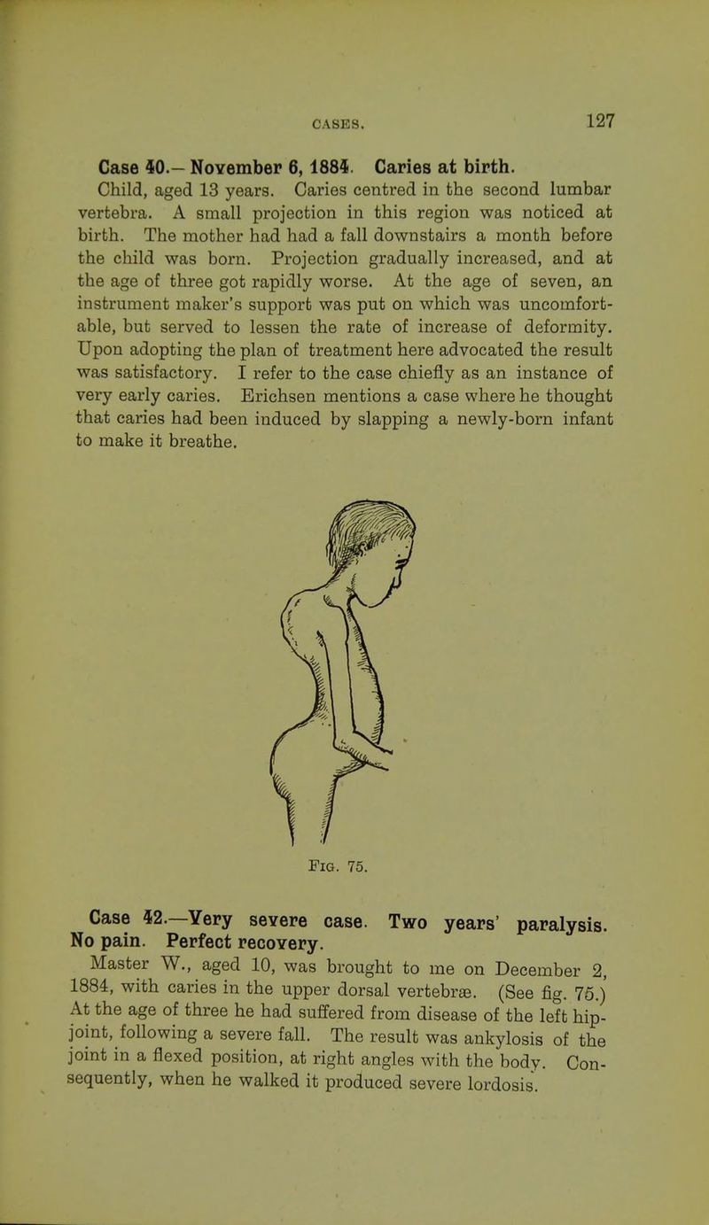 Case 40.- November 6,1884. Caries at birth. Child, aged 13 years. Caries centred in the second lumbar vertebra. A small projection in this region was noticed at birth. The mother had had a fall downstairs a month before the child was born. Projection gradually increased, and at the age of three got rapidly worse. At the age of seven, an instrument maker's support was put on which was uncomfort- able, but served to lessen the rate of increase of deformity. Upon adopting the plan of treatment here advocated the result was satisfactory. I refer to the case chiefly as an instance of very early caries. Erichsen mentions a case where he thought that caries had been induced by slapping a newly-born infant to make it breathe. Case 42.—Yery severe case. Two years' paralysis. No pain. Perfect recovery. Master W., aged 10, was brought to me on December 2, 1884, with caries in the upper dorsal vertebrae. (See fig. 75.) At the age of three he had suffered from disease of the left hip- joint, following a severe fall. The result was ankylosis of the joint in a flexed position, at right angles with the body. Con- sequently, when he walked it produced severe lordosis. Fig. 75.