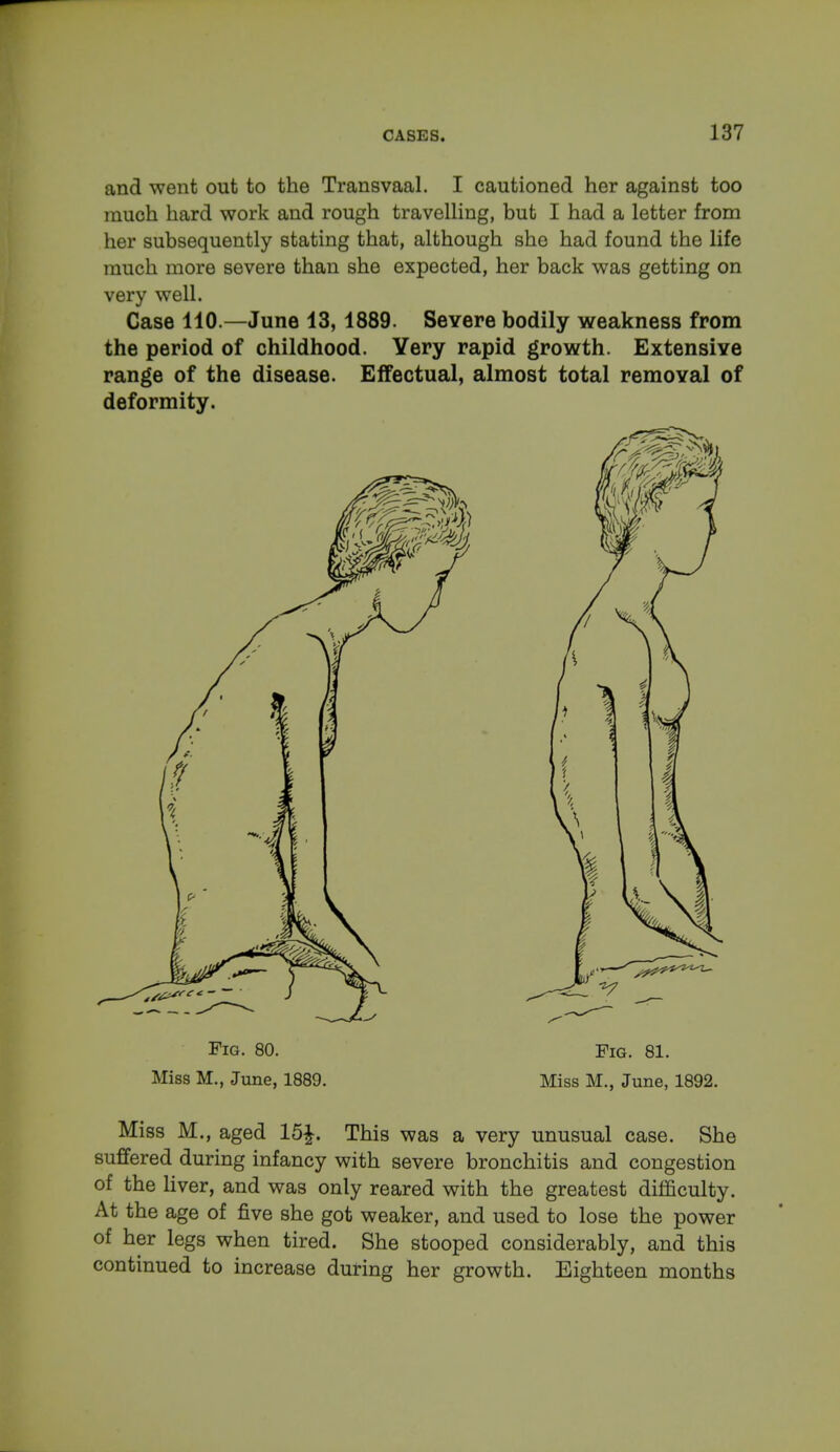 and went out to the Transvaal. I cautioned her against too much hard work and rough travelling, but I had a letter from her subsequently stating that, although she had found the life much more severe than she expected, her back was getting on very well. Case 110.—June 13, 1889. Severe bodily weakness from the period of childhood. Yery rapid growth. Extensive range of the disease. Effectual, almost total removal of deformity. Fig. 80. Fig. 81. Miss M., June, 1889. Miss M., June, 1892. Miss M., aged 15|. This was a very unusual case. She suffered during infancy with severe bronchitis and congestion of the liver, and was only reared with the greatest difficulty. At the age of five she got weaker, and used to lose the power of her legs when tired. She stooped considerably, and this continued to increase during her growth. Eighteen months