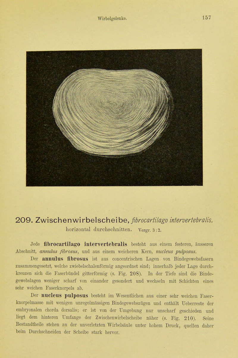 209. Zwischenwirbelscheibe, ^i^m^zr/Z/ij^o intervertebralis. horizontal durchschnitten. Vergr. 3:2. Jede flbrocartilago intervertebralis besteht aus eiuem festeren, iiiisseren Abschnitt, annulus fihrosus, und aus einem weicheren Kern, nucleus pulposus. Der annulus librosus ist aus concentrischen Lagen von Bindegewebsfasern zusammengesetzt, welche zwiebelscbalenfonnig angeordnet sind; innerhalb jeder Lage durch- kreuzen sich die Faserbiindel gitterformig (s. Fig. 208). In der Tiefe sind die Binde- gewebslagen weniger scliarf von oinander gesondert und wechseln mit Schichten eiues sehr weichen Faserknorpols ab. Der nucleus pulposus besteht im Wesentlichen aus einer sehr weicben Faser- knorpelmasse mit wenigen unregelmilssigen Bindcgewebszugen und entbfilt Ueberreste der embryonalen chorda dorsalis; er ist von der TJuigebung nur unscharf geschieden und liegt dam hinteren Umfange der Zwischonwirbelscheibe niiher (s. Fig. 210). Seine Bestandtheile stehen an der unverletzten Wirbelsaule unter hohem Druck, quellen daher beim Durchschneiden der Scheibe stark hervor.