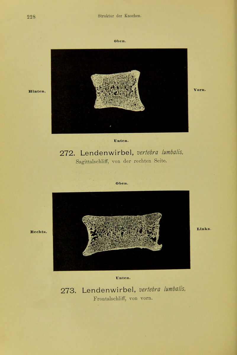 Oben. Hlnten. Vorn. Vnten. 272. Lendenwirbel, vertebra lumbalis. Sagittalschliff, von der rechten Seite. Olien. BechtH. Links. I'nton. 273. Lendenwirbel, vertebra lumbalis.