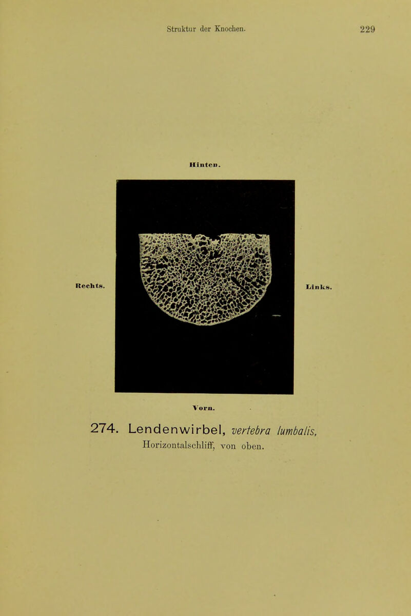 Ilintcn. Rechts. Y'oru. 274. Lendenwirbel, vertebra lumbalis.