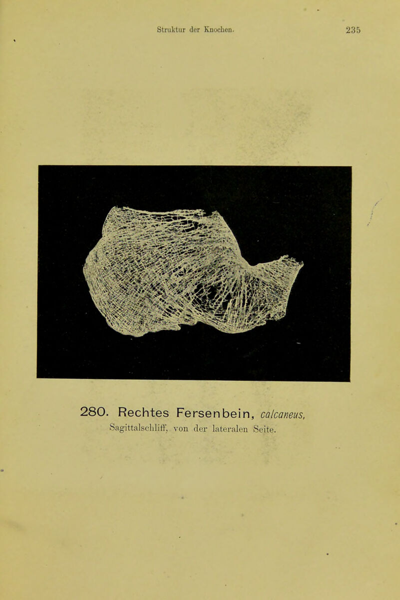 280. Rechtes Fersenbein, calcaneus. Sagittalschlift', von der lateralen Seite.