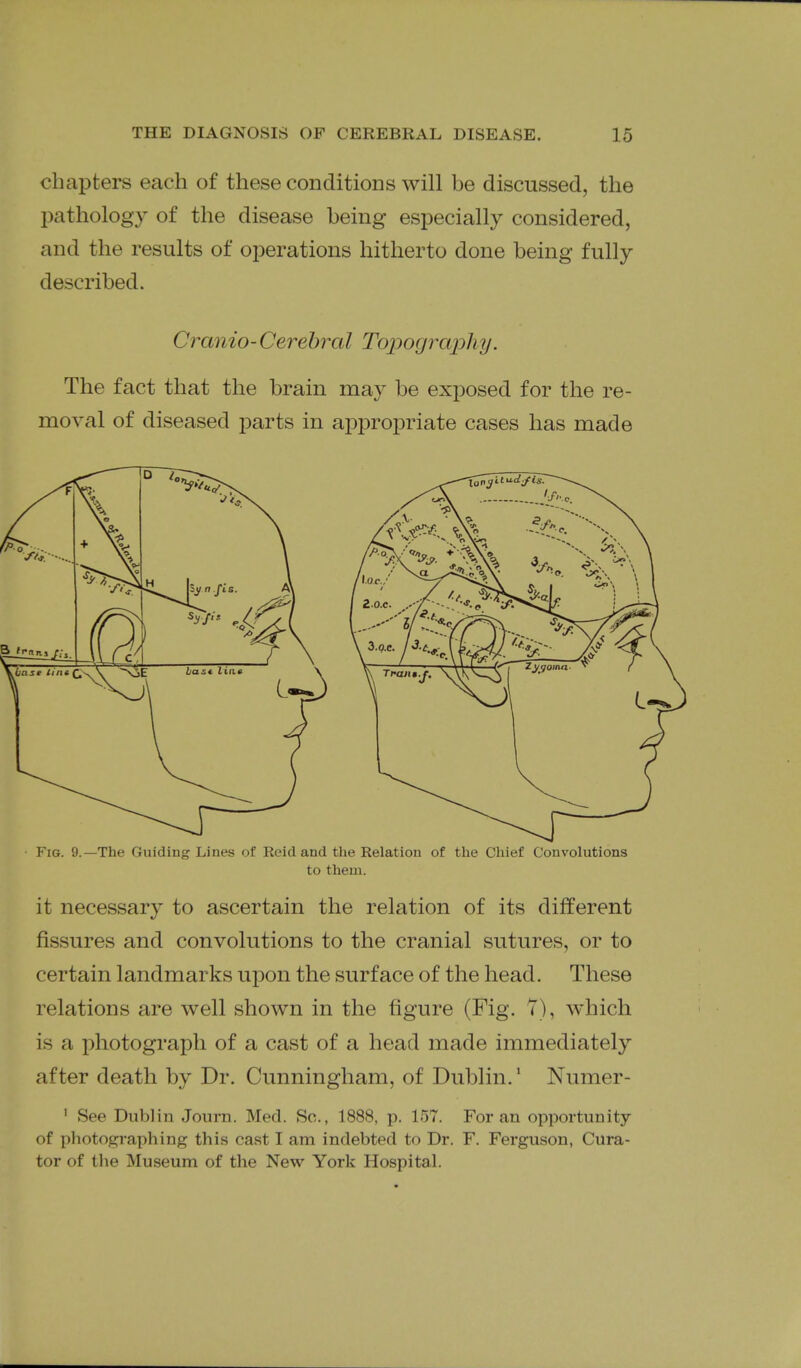 chapters each of these conditions will be discussed, the pathology of the disease being especially considered, and the results of operations hitherto done being fully described. Cranio-Cerebral Topogra2Dhy. The fact that the brain may be exposed for the re- moval of diseased jDarts in appropriate cases has made Fig. 9.—The Guiding Lines of Reid and the Relation of the Chief Convolutions to them. it necessary to ascertain the relation of its different fissures and convolutions to the cranial sutures, or to certain landmarks upon the surface of the head. These relations are well shown in the figure (Fig. 7), which is a photograph of a cast of a head made immediately after death by Dr. Cunningham, of Dublin.' Numer- ' See Dublin Journ. Med. So., 1888, p. 157. For an opportunity of photop^raphing this cast I am indebted to Dr. F. Ferguson, Cura- tor of tlie Museum of the New York Hospital.