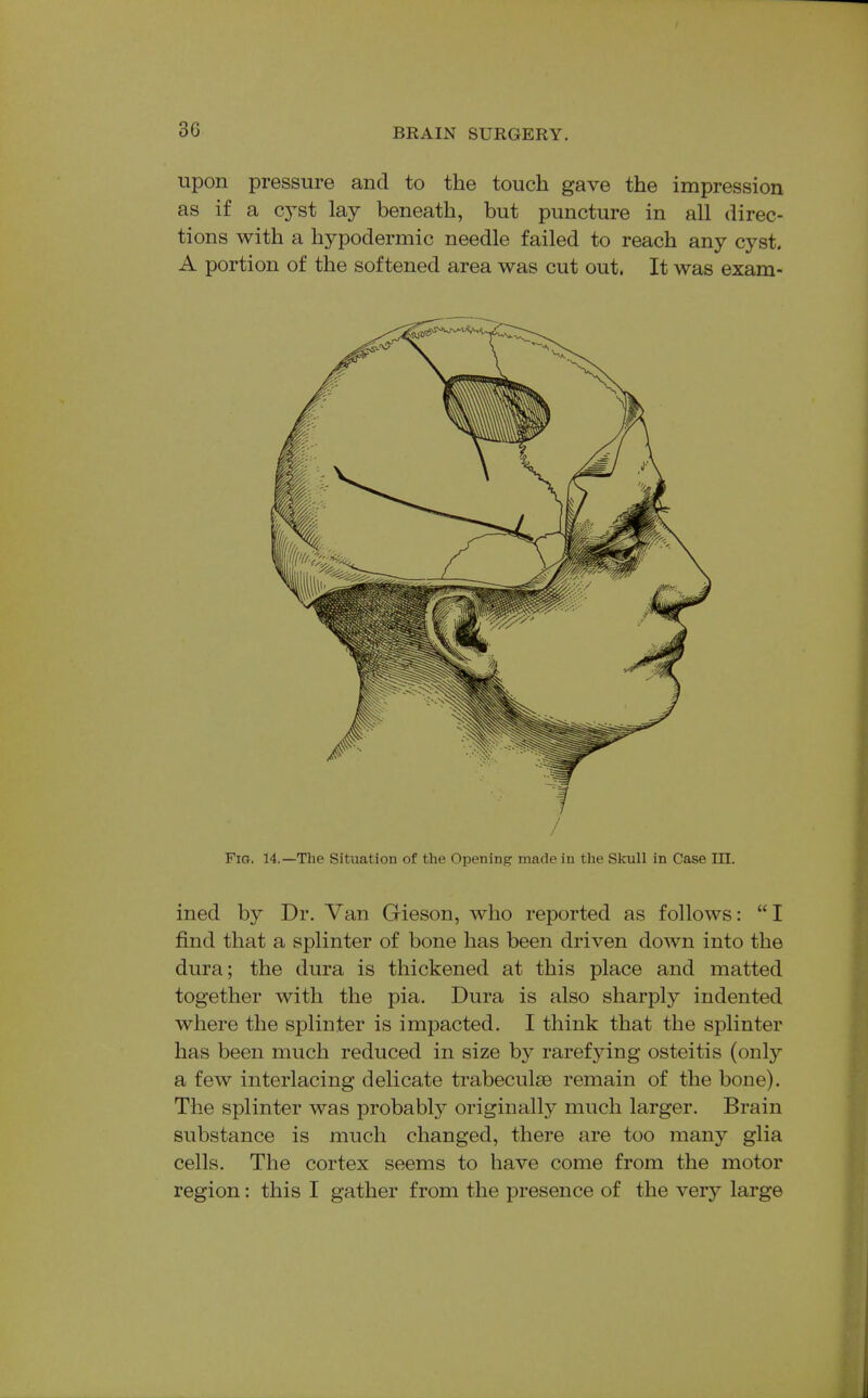 upon pressure and to the touch gave the impression as if a cyst lay beneath, but puncture in all direc- tions with a hypodermic needle failed to reach any cyst. A portion of the softened area was cut out. It was exam- /' Fig, 14.—The Situation of the Opening made in the Skull in Case in. ined by Dr. Van Gieson, who reported as follows: I find that a splinter of bone has been driven down into the dura; the dura is thickened at this place and matted together with the pia. Dura is also sharply indented where the splinter is impacted. I think that the splinter has been much reduced in size by rarefying osteitis (only a few interlacing delicate trabeculse remain of the bone). The splinter was probabl}^ originally much larger. Brain substance is much changed, there are too many glia cells. The cortex seems to have come from the motor region: this I gather from the presence of the very large