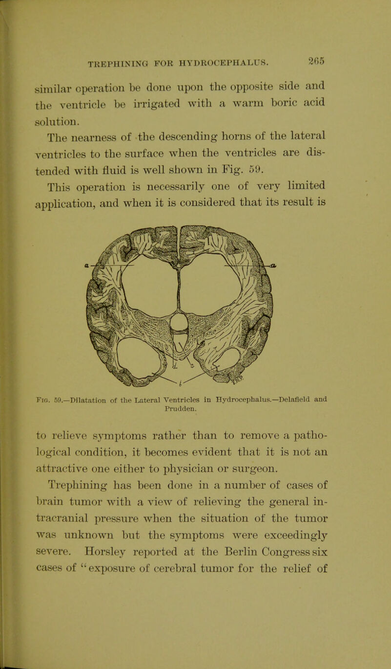 similar operation be done upon the opposite side and the ventricle be irrigated with a warm boric acid solution. The nearness of the descending horns of the lateral ventricles to the surface when the ventricles are dis- tended with fluid is well shown in Fig. 59. This operation is necessarily one of very limited application, and when it is considered that its result is Fig. 59.—Dilatation of the Lateral Ventricles in Hydrocephalus.—Delafield and Prudden. to relieve symptoms rather than to remove a patho- logical condition, it becomes evident that it is not an attractive one either to physician or surgeon. Trephining has been done in a number of cases of brain tumor with a view of relieving the general in- tracranial pressure when the situation of the tumor was unknown but the symptoms were exceedingly severe. Horsley reported at the Berlin Congress six cases of exposure of cerebral tumor for the relief of