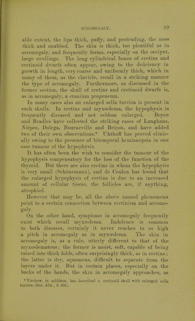 al)le extent, tlio lips tliick, putty, and protrudinpi;, the nose thick and snubbed. The skin is thick, too plentiful as in acromegaly, and frequently forms, especially on the occiput, large svrellings. The long cylindrical bones of cretins and cretinoid dwarfs often appear, owing to the deficiency in growth in length, very coarse and uniformly thick, which in many of them, as the clavicle, recall in a striking manner the type of acromegaly. Furthermore, as discussed in the former section, the skull of cretins and cretinoid dwarfs is, as in acromegaly, a cranium progeneum. In many cases also an enlarged sella turcica is present in such skulls. In cretins and niyxoedema, the hypophysis is frequently diseased and not seldom enlarged. Boyco and Beadles have collected the striking cases of Langhans, Niepce, Dolega, Bourneville and Bricon, and have added two of their own observations.* Uhthoff has proved clinic- ally owing to the presence of bitemporal hemianopsia in one case tumour of the hypophysis. It has often been the wish to consider the tumour of the hypophysis compensatory for the loss of the function of the thyroid. But there are also cretins in whom the hypophysis is very small (Schcinemann), and de Coulon has found that the enlarged hypophysis of cretins is due to an increased amount of cellular tissue, the follicles are, if anything, atrophied. However that may be, all the above named phenomena point to a certain connection between cretinism and acrome- galy- On the other hand, symptoms in acromegaly frequently exist which recall mvxoedema. Indolence is common to both diseases, certainly it never reaches to so high a pitch in acromegaly as in myxcedema. The skin in. acromegaly is, as a rule, utterly different to that of the myxoedematous ; the former is moist, soft, capable of being raised into thick folds, often surprisingly thick, as in cretins ; the latter is dry, squamous, difficult to separate from the laj'ers under it. But in certain places, especially on the backs of the hands, the skin in acromegaly approaches, as * Virchow, in addition, hag described a cretinoid sknll with enlarged sella turcica (Gea. Abh., S. 905).
