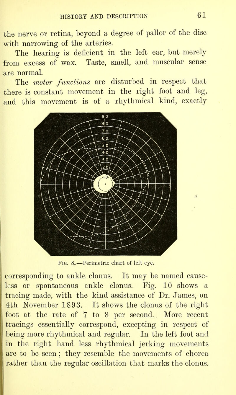 the nerve or retina, beyond a degree of pallor of the disc with narrowing of the arteries. The hearing is deficient in the left ear, but merely from excess of wax. Taste, smell, and muscular sense are normal. The motor functions are disturbed in respect that there is constant movement in the riglit foot and leg, and this movement is of a rhythmical kind, exactly Fig. 8.—Perimetric chart of left eye. corresponding to ankle clonus. It may be named cause- less or spontaneous ankle clonus. Fig. 10 shows a tracing made, with the kind assistance of Dr. James, on 4th ISTovember 1893. It shows the clonus of the right foot at the rate of 7 to 8 per second. More recent tracings essentially correspond, excepting in respect of being more rhythmical and regular. In the left foot and in the right hand less rhythmical jerking movements are to be seen; they resemble the movements of chorea rather than the regular oscillation that marks the clonus.