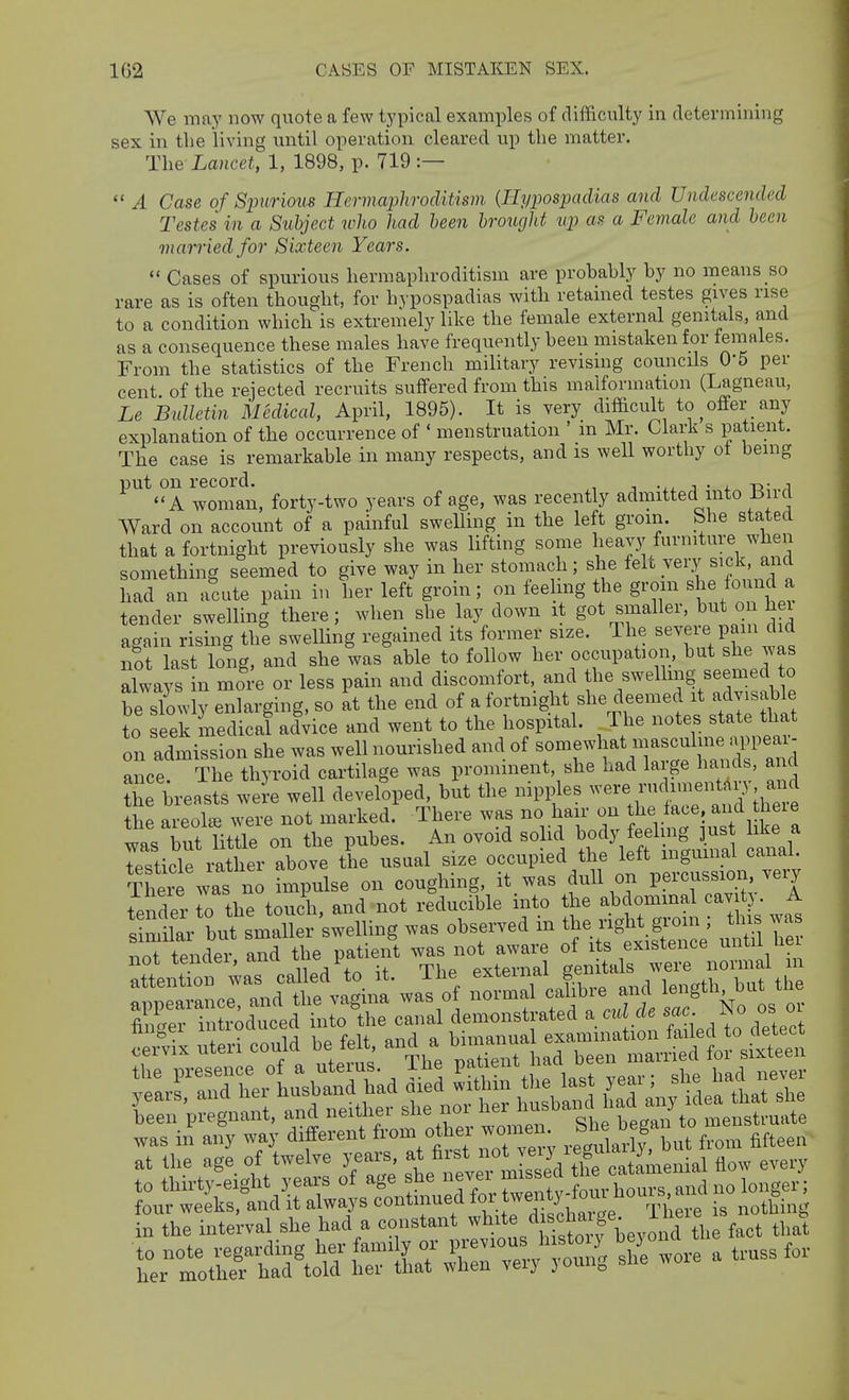 We may now quote a few typical examples of difficvilty in determining sex in the living until operation cleared up the matter. Tlie Lancet, 1, 1898, p. 719 :—  A Case of Sjmrious Hermaphroditism {I-Iyjios'padias and Undescended Testes in a Subject who had been brought up as a Female and been married for Sixteen Years.  Cases of spurious hermaphroditism are probably by no means so rare as is often thought, for hypospadias with retained testes gives rise to a condition which is extremely like the female external genitals, and as a consequence these males have frequently been mistaken for females. From the statistics of the French military revising councils 0'5 per cent of the rejected recruits suffered from this malformation (Lagneau, Le bulletin Medical, April, 1895). It is very difi&cult to offer any explanation of the occurrence of ' menstruation ' in Mr. Clark s patient. The case is remarkable in many respects, and is well worthy ot being ^''^^ A woman, forty-two years of age, was recently admitted into Bird Ward on account of a painful swelling in the left groin. She stated that a fortnight previously she was lifting some heavy furniture when something seemed to give way in her stomach ; she felt very sick, and had an acute pain in her left groin; on ieehng the groin she found a tender swelling there; when she lay down it got smaller, but o hei again rising the swelling regained its former size. The severe pam did not last long, and she was able to follow her occupation, but she was always in more or less pain and discomfort, and th^Bwellmg seemed o be slowly enlarging, so at the end of a fortnight she deemed it advisable to ek medical advice and went to the hospital. The notes state that on admission she was well nourished and of ^o-.-l-X'SS^ a d ance The thyroid cartilage was prominent, she had laige hands, ancl h breasts weL well developed, but the mpples --e^ndnnenta^^^^^^^^^^ the areola, were not marked. There was no hair on ; ^^^^ was but little on the pubes. An ovoid solid f„f ^^^^^^ tP^ticle rather above the usual size occupied the lett inguinal canai. Ther was 0 impulse on coughing, it was dull on PercusBion ^eiy tender to the touch, and not reducible into the abdommal cav tj. A Sar but smaller 'swelling was observed in the ngM ^^^^^^^^^ ^ - not tender, and the patient was not awai^^^ in been pregnant, and neiUiei nui menstruate was in any way different fron^ other woinen ^hej^^ g'^^^^^^^^.^,^^ fifteen