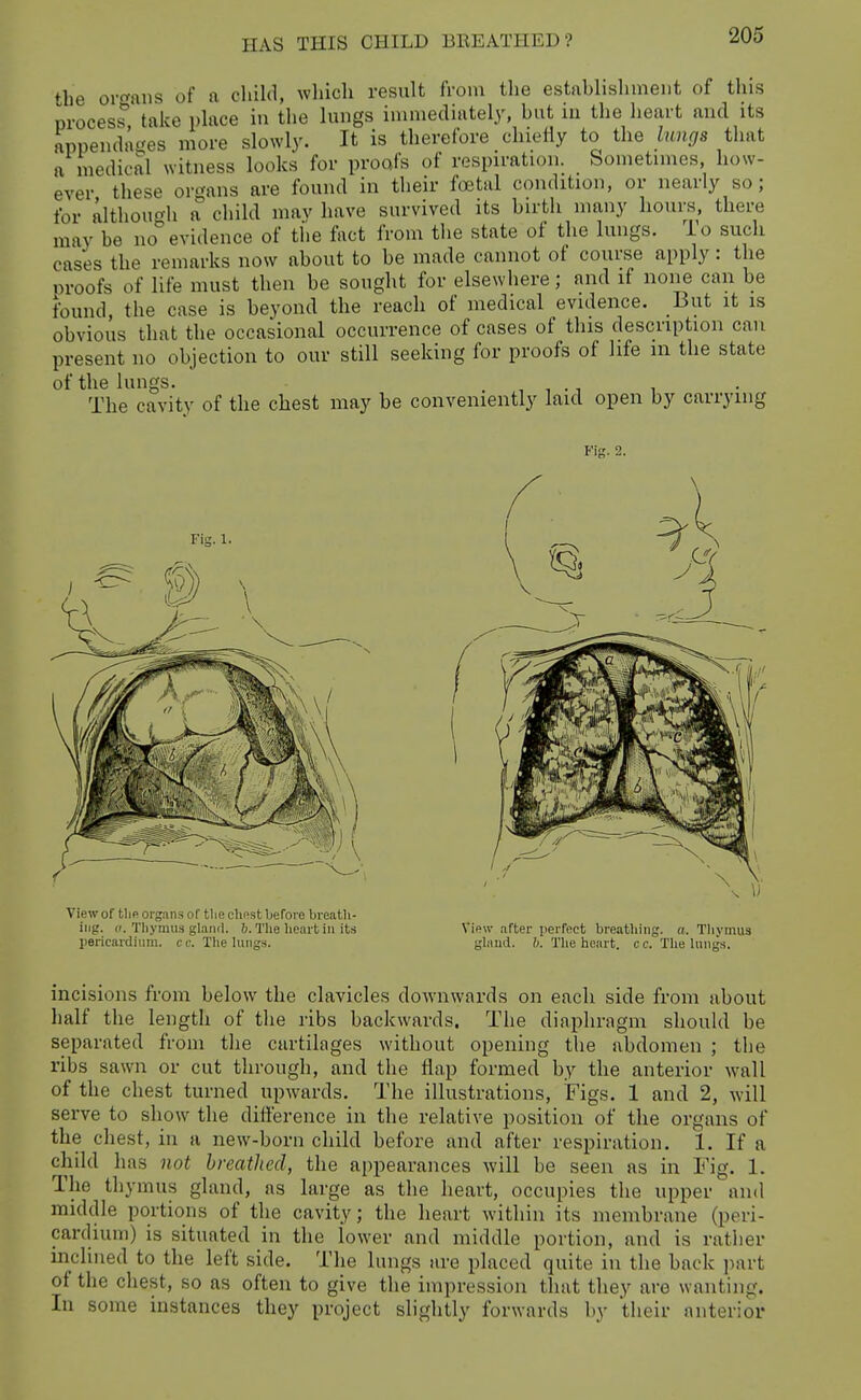 the ovf^ans of a child, which result from the establishment of this process^ take place in the lungs immediately, but iu the heart and its appenda<'es more slowly. It is therefore chiefly to the lungs that a medical witness looks for proofs of respiration. Sometimes, how- ever these or<^ans are found in tlieir foetal condition, or nearly so; for although a° child mav have survived its birth many hours, there may be no evidence of tlie fact from tlie state of the lungs. To such cases the remarks now about to be made cannot of course apply: the proofs of life must then be sought for elsewhere; and if none can be found, the case is beyond the reach of medical evidence. But it is obvious that the occasional occurrence of cases of this description can present no objection to our still seeking for proofs of life m the state of the lungs. , , ., , The cavity of the chest may be conveniently laid open by carrying Fig. 2. Fig. 1. View of the organs of tlie cliest before breath- ing, o. ThymiKs glanil. 6. Tlie heart iu its pericardium, co. Tlie lungH. View after iierfect breathing, a. Thymus glaud. b. The heart, cc. The Inng.s. incisions from below the clavicles downwards on each side from about half the length of the ribs backwards. The diaphragm should be separated from the cartilages without opening the abdomen ; the ribs sawn or cut through, and the flap formed by the anterior wall of the chest turned upwards. The illustrations, Figs. 1 and 2, will serve to show the difference in the relative position of the organs of the chest, in a new-born child before and after respiration. 1. If a child has not breathed, the appearances will be seen as in Fig. 1. The thymus gland, as large as the heart, occupies the upper and middle portions of the cavity; the heart within its membrane (peri- cardium) is situated in the lower and middle portion, and is rather inclined to the left side. The lungs are placed quite in the back part of the chest, so as often to give the impression that they are wanting. In some instances they project slightly forwards by tlieir anterior