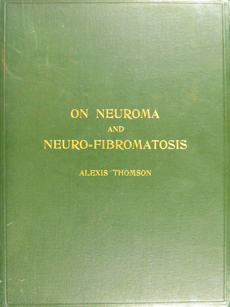 ON NEUROMA AND NEURO-FIBROMATOSIS ALEXiS.:.;:grt^^OMS0N