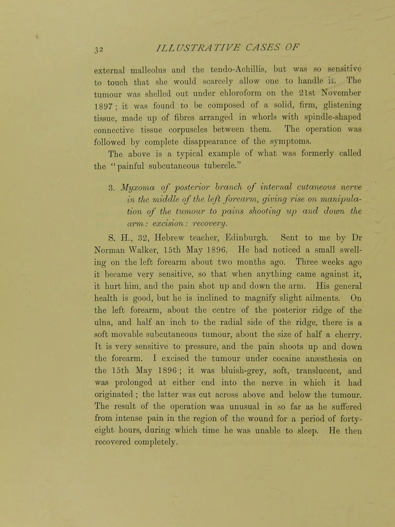 external malleolus and the tendo-Aclullis, but was so sensitive to touch that she would scarcely allow one to handle it. The tumour was shelled out under cliloroform on the 21st November 1897; it was found to be composed of a solid, firm, glistening tissue, made up of fibres arranged in whorls with spindle-shaped connective tissue corpuscles between them. The operation was followed by complete disappearance of the symptoms. The above is a typical example of what was formerly called the painful subcutaneous tubercle. 3. Myxoma of posterior branch of internal cutaneous nerve in the middle of the left forearm, giving rise on manipula- tion of the tumour to pains shooting up and down the arm: excision: recovery. S. H., 32, Hebrew teacher, Edinburgh. Sent to me by Dr Norman Walker, 15tli May 1896. He had noticed a small swell- ing on the left forearm about two months ago. Three weeks ago it became very sensitive, so that when anything came against it, it hurt him, and the pain shot up and down the arm. His general health is good, but he is inclined to magnify slight ailments. On the left forearm, about the centre of the posterior ridge of the ulna, and half an inch to the radial side of th(3 ridge, there is a soft movable subcutaneous tumour, about the size of half a cherry. It is very sensitive to pressure, and the pain shoots up and down the forearm. I excised the tumour under cocaine ansesthesia on the 15th May 1896; it was bluish-grey, soft, translucent, and was prolonged at either end into the nerve. in which it had originated; the latter was cut across above and below the tumour. The result of the operation was unusual in so far as he suffered from intense pain in the region of the wound for a period of forty- eight hours, during which time he was unable to sleep. He then recovered completely.