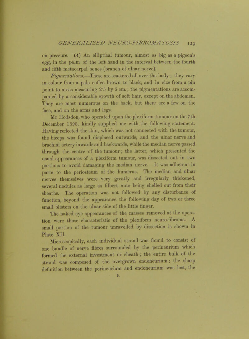 on pressure. (,4) An elliptical tumour, almost as big as a pigeon's egg, in the palm of the left hand in the interval between the fourth and fifth metacarpal bones (branch of ulnar nerve). Pigmentations.—These are scattered all over the body ; they vary in colour from a pale coffee brown to black, and in size from a pin point to areas measuring 2-5 by 5 cm.; the pigmentations are accom- panied by a considerable growth of soft hair, except on the abdomen. They are most numerous on the back, but there are a few on the face, and on the arms and legs. Mr Hodsdon, who operated upon the plexiform tumour on the 7th December 1898, kindly supplied me with the following statement. Having reflected the skin, which was not connected with the tumour, the biceps was found displaced outwards, and the ulnar nerve and brachial artery inwards and backwards, while the median nerve passed through the centre of the tumour ; the latter, which presented the usual appearances of a plexiform tumour, was dissected out in two portions to avoid damaging the median nerve. It was adherent in parts to the periosteum of the humerus. The median and ulnar nerves themselves were very greatly and irregularly thickened, several nodules as large as filbert nuts being shelled out from their sheaths. The operation was not followed by any disturbance of function, beyond the appearance the following day of two or three small blisters on the ulnar side of the little finger. The naked eye appearances of the masses removed at the opera- tion were those characteristic of the plexiform neuro-fibroma. A small portion of the tumour unravelled by dissection is shown in Plate XII. JVIicroscopically, each individual strand was found to consist of one bundle of ner\'e fibres surrounded by the permeurium which formed the external investment or sheath ; the entire bulk of the strand was composed of the overgrown endoneurium; the sharp definition between the perineurium and endoneurium was lost, the K