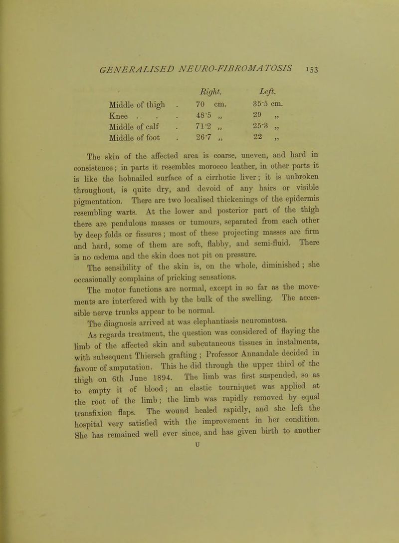 Right. Left. Middle of thigh . 70 cm. 35-5 cm. Knee . . • 48-5 „ 29 „ Middle of calf . 7r2 „ 25-3 „ Middle of foot . 267 „ 22 „ The skin of the affected area is coarse, uneven, and hard in consistence; in parts it resembles morocco leather, in other parts it is like the hobnailed surface of a cirrhotic liver; it is unbroken throughout, is quite dry, and devoid of any hairs or visible pigmentation. There are two localised thickenings of the epidermis resembling warts. At the lower and posterior part of the thigh there are pendulous mas-ses or tumours, separated from each other by deep folds or fissures; most of these projecting masses are firm and hard, some of them are soft, flabby, and semi-fluid. There is no oedema and the skin docs not pit on pre.ssure. The sensibility of the skin is, on the whole, diminished; she occasionally complains of pricking sensations. The motor functions are normal, except in so far as the move- ments are interfered with by the bulk of the swelling. The acces- sible nerve trunks appear to be normal. The diagnosis arrived at was elephantia.sis neuromatosa. As regards treatment, the question was considered of flaying the limb of the affected skin and subcutaneous tissues in instalments, with subsequent Tliiersch grafting ; Professor Annandale decided in favour of amputation. This he did through the upper third of the thigh on 6th June 1894. The limb was first suspended, so as to empty it of blood; an ela.stic tourniquet was applied at the root of the limb; the limb was rapidly removed by equal transfixion flaps. The wound healed rapidly, and she left the hospital very satisfied with the improvement in her condition. She has remained well ever since, and has given birth to another u