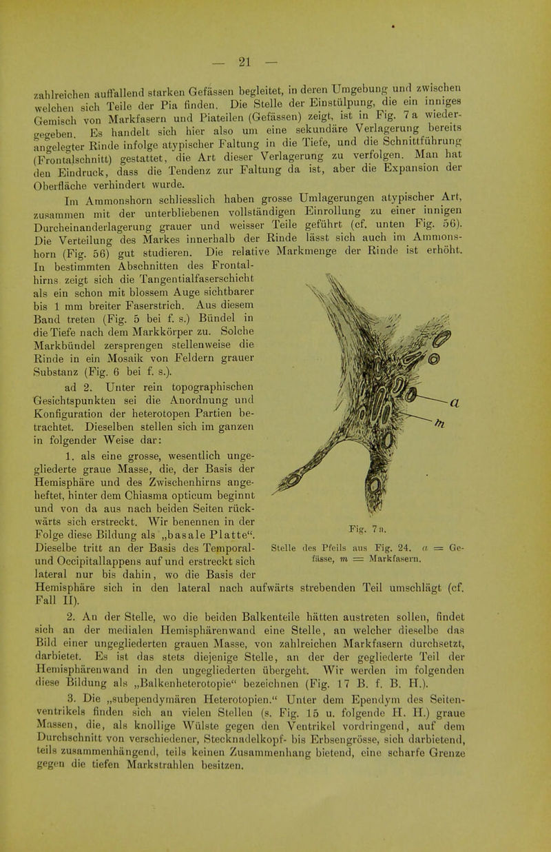 zahlreichen auffallend starken Gefassen begleitet, in deren Umgebung und zw.schen welohen aich Teile der Pia finden. Die Stelle der Einstulpung, die em inniges Gemisch von Markfasern und Piateilen (Gefassen) zeigt, ist in Fig. 7 a w.eder- wcreben Ea handelt sich hier also urn eine sekundare Verlagerung bereits angele°ter Rinde infolge atypischer Faltung in die Tiefe, und die Schnittfiihrung (Frontalschnitt) gestattet, die Art dieser Verlagerung zu verfolgen. Man hat den Eindruck, dass die Tendenz zur Faltung da ist, aber die Expansion der Oberflache verhindert wurde. Im Ammonshorn schliesslich haben grosse Umlagerungen atypischer Art, zusamnien mit der unterbliebenen vollstandigen Einrollung zu einer innigen Durcheinanderlagerung grauer und weisser Teile gefuhrt (cf. unten Fig. 56). Die Verteilung des Markes innerhalb der Rinde lasst sich auch im Ammons- horn (Fig. 56)' gut studieren. Die relative Markmenge der Rinde ist erhoht. In bestimmten Abschnitten des Frontal- hirns zeigt sich die Tangentialfaserschicht als ein schon mit blossem Auge sichtbarer bis 1 mm breiter Faserstrich. Aus diesem Band treteu (Fig. 5 bei f. s.) Bundel in die Tiefe nach dem Markkorper zu. Solche Markbiindel zersprengen stellenweise die Rinde in ein Mosaik von Feldern grauer Substanz (Fig. 6 bei f. s.). ad 2. Unter rein topographischen Gesichtspunkten sei die Anordnung und Konfiguration der heterotopen Partien be- trachtet. Dieselben stellen sich im ganzen in folgender Weise dar: 1. als eine grosse, wesentlich unge- gliederte graue Masse, die, der Basis der Hemisphare und des Zwischenhirns ange- heftet, hinter dem Chiasma opticum beginnt und von da aus nach beiden Seiten nick- warts sich erstreckt. Wir benennen in der Folge diese Bildung als „basale Platte. Dieselbe tritt an der Basis des Temporal- und Occipitallappens auf und erstreckt sich lateral nur bis dahin, wo die Basis der Hemisphare sich in den lateral nach aufwarts strebenden Teil umschliigt (cf. Fall II). 2. An der Stelle, wo die beiden Balkeuteile hatten austreten sollen, findel sich an der medialen Hemispharenwand eine Stelle, an welcher dieselbe das Bild einer ungegliederten grauen Masse, von zahlreichen Markfasern durchsetzt, darbietet. Es ist das stets diejenige Stelle, an der der gegliederte Teil der Hemispharenwand in den ungegliederten iibergeht. Wir werden im folgenden diese Bildung als „Balkenheterotopie bezeichnen (Fig. 17 B. f. B. H.). 3. Die „subependymaren Heterotopien. Unter dem Ependym des Seiten- ventrikels finden sich an vieleu Stellen (s. Fig. 15 u. folgende H. H.) graue Massen, die, als knollige VViilste gegen den Ventrikel vordringend, auf dem Durchschnitt von verschiedener, Stecknadelkopf- bis Erbsengrosse, sich darbietend, teils zusammenhtingend, teils keinen Zusammenhang bietend, eine scharfe Grenze gegen die tiefen Markstrahlen besitzen. Fig. 7n. Stelle des Pfeils aus Fig. 24. a = Ge- filsse, m = Markfasern.