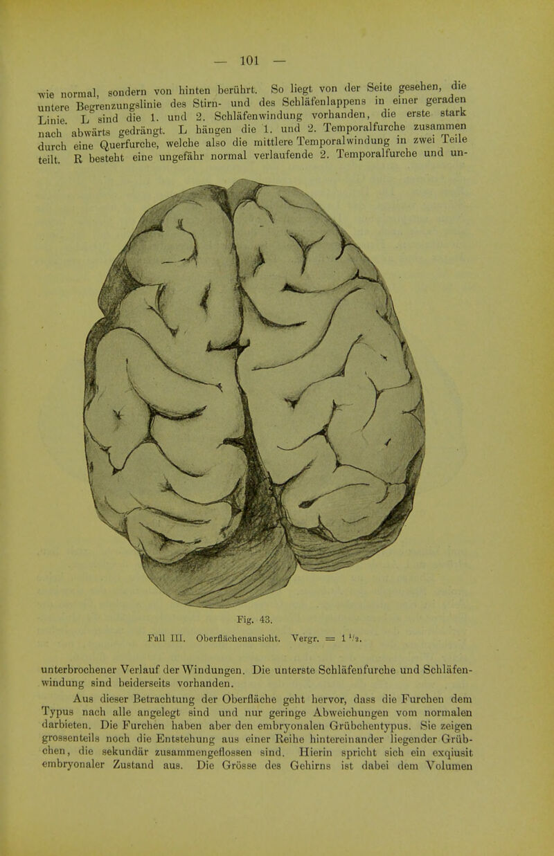 wie normal sondern von hinten beruhrt. So liegt von der Seite gesehen, die untere Be-renzungslinie des Stirn- und des Schlafenlappens in einer geraden Linie L sind die 1. und 2. Schlafenwindung vorhanden, die erste stark nach' abwarts gedrangt. L haugen die 1. und 2. Temporalfurche zusammen durch eine Querfurche, welche also die raittlere Temporalwindung in zwei Telle teilt R besteht eine ungefahr normal verlaufende 2. Temporalfurche und un- Fig. 43. Fall III. Oberfluchenansicht. Vergr. unterbrochener Verlauf der Windungen. Die unterste Schlafenfurche und Schlafen- windung sind beiderseits vorhanden. Aus dieser Betrachtung der Oberflache geht hervor, dass die Furchen dem Typus nach alle angelegt sind und nur geringe Abweichungen vom normalen darbieten. Die Furchen haben aber den embryonalen Griibchentypus. Sie zeigen grossenteils noch die Entstehung aus einer Reihe hintereinander liegender Griib- chen, die sekundar zusamraengeflossen sind. Hierin spricht sich ein exqiusit embryonaler Zustand aus. Die Grosse des Gehirns ist dabei dem Volumen