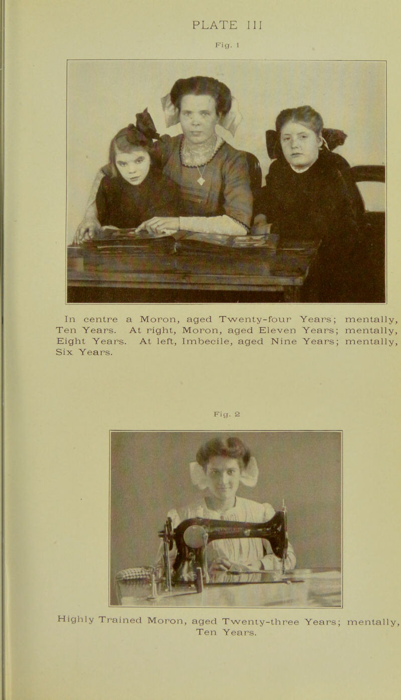 Fig. 1 In centre a Moron, aged Twenty-four Years; mentall Ten Years. At right, Moron, aged Eleven Years; mentall Eight Years. At left, Imbecile, aged Nine Years; mentall Six Years. Fig. 2 Highly Trained Moron, aged Twenty-three Years; Ten Years. m entail