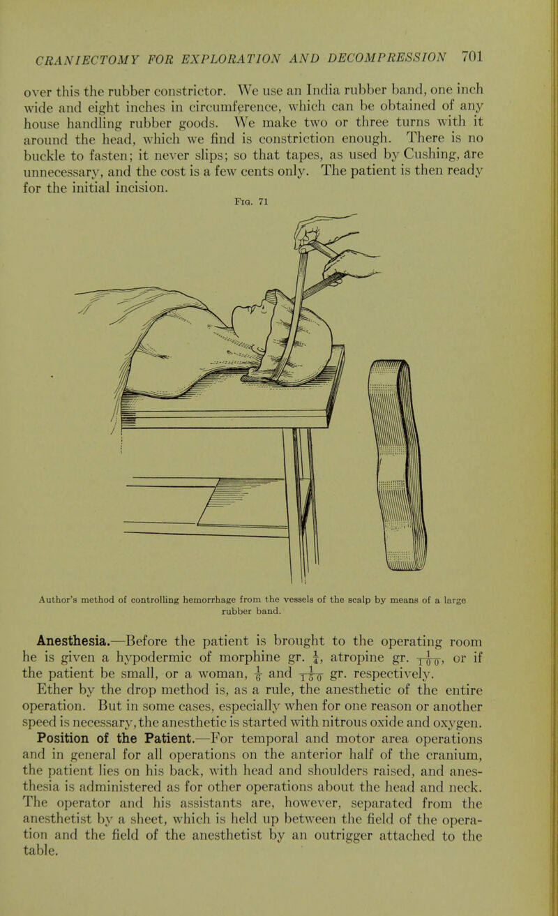 over this the rubber constrictor. We use an India rubber band, one inch wide and eight inches in circumference, which can be obtained of any house handling rubber goods. We make two or three turns with it around the head, which we find is constriction enough. There is no buckle to fasten; it never shps; so that tapes, as used by Gushing, are unnecessary, and the cost is a few cents only. The patient is then ready for the initial incision. Fia. 71 Author's method of controlling hemorrhage from the vessels of the scalp by means of a large rubber band. Anesthesia.—Before the patient is brought to the operating room he is given a hypodermic of morphine gr. |, atropine gr. j^-q, or if the patient be small, or a woman, ^ and y^-o S^- respectivel3^ Ether by the drop method is, as a rule, the anesthetic of the entire operation. But in some cases, especially when for one reason or another speed is necessary, the anesthetic is started with nitrous oxide and oxygen. Position of the Patient.—For temporal and motor area operations and in general for all operations on the anterior half of the cranium, the patient lies on his back, with head and shoulders raised, and anes- thesia is administered as for other operations about the head and neck. The operator and his assistants are, however, separated from the anesthetist by a sheet, which is held up between the field of the opera- tion and the field of the anesthetist by an outrigger attached to the table.