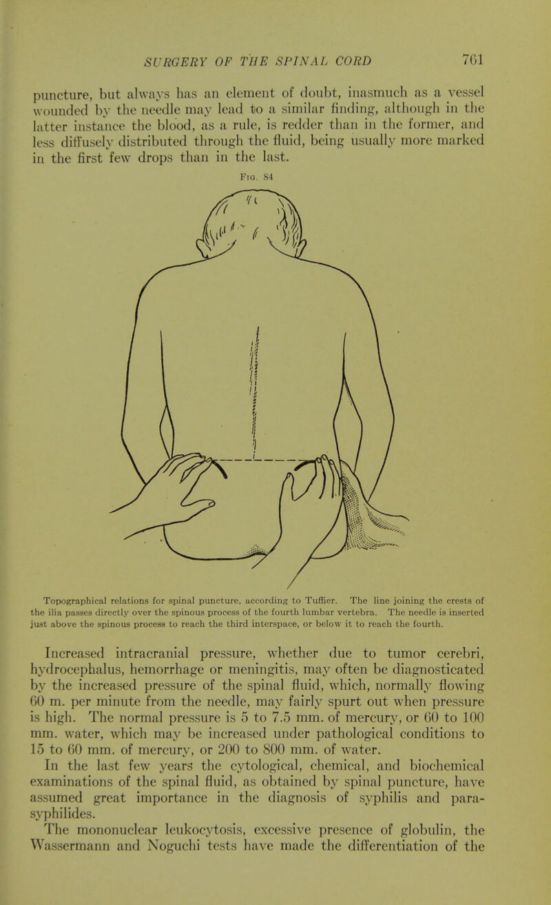 puncture, but always has an element of doubt, inasmuch as a vessel wounded by the needle may lead to a similar finding, although in the latter instance the blood, as a rule, is redder than in the former, and less diffusely distributed through the fluid, being usually more marked in the first few drops than in the last. Fra. 84 Topographical relations for spinal puncture, according to Tuffier. The line joining the crests of the ilia passes directly over the spinous process of the fourth lumbar vertebra. The needle is inserted just above the spinous process to reach the third interspace, or below it to reach the fourth. Increased intracranial pressure, whether due to tumor cerebri, hydrocephalus, hemorrhage or meningitis, may often be diagnosticated by the increased pressure of the spinal fluid, which, normally flowing 60 m. per minute from the needle, may fairly spurt out when pressure is high. The normal pressure is 5 to 7.5 mm. of mercury, or GO to 100 mm. water, which may be increased under pathological conditions to 15 to 60 mm. of mercury, or 200 to 800 mm. of water. In the last few years the cytological, chemical, and biochemical examinations of the spinal fluid, as obtained hy spinal puncture, have assumed great importance in the diagnosis of syphilis and para- syphilides. The mononuclear leukocytosis, excessive presence of globulin, the Wassermann and Noguchi tests have made the difl'erentiation of the