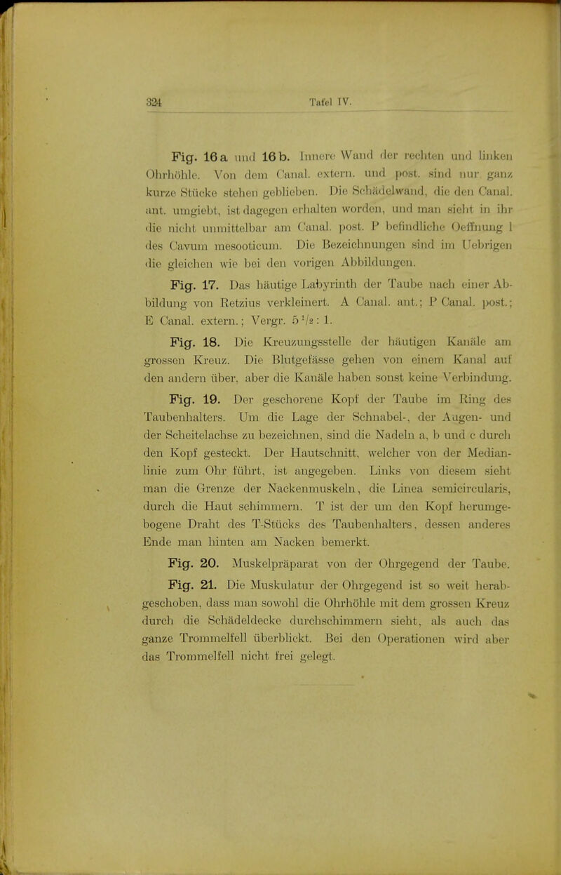 324 Tutel IV. Fig. 16 a und 16b. Inncir Wand der rechten und linken Ohrhühle. Von dorn ('nnal. oxtei-n. und post. sind nur ganz kurze Stücke stehen geblieben. Die Schädelwand, die den Canal. ant. umgiebt, ist dagegen erhalten worden, und man sieht in ihi- die nicht unmittelbar am (Janal. post. P befindliche Oellimng I des Cavum mesooticum. Die Bezeichnungen sind im Uebrigen die gleichen wie bei den vorigen Abbildungen. Fig. 17. Das häutige Labyrinth der Taube uacli einer Ab- bildung von Ketzins verkleinert. A Canal. ant.; P Canal. ])ost.; E Canal. extern.; Vergr. 5Varl. Fig. 18, Die Kreuzungsstelle der häutigen Kanäle am gi'ossen Kreuz. Die Blutgefässe gehen von einem Kanal auf den andern über, aber die Kanäle haben sonst keine ^^erbindung. Fig. 19. Der geschorene Kopf der Taube im Ring des Taubenhalters. Um die Lage der Schnabel-, der Augen- und der Scheitelachse zu bezeichnen, sind die Nadeln a, b und c durch den Kopf gesteckt. Der Hautschnitt, welcher von der Median- linie zum Ohr führt, ist angegeben. Links von diesem .sieht man die Grenze der Nackenmuskeln, die Linea semicircularis, durch die Haut schimmern. T ist der um den Kopf herumge- bogene Draht des T-Stücks des Taubenhalters, dessen anderes Ende man hinten am Nacken bemerkt. Fig. 20. Muskelpräparat von der Ohrgegend der Taube. Fig. 21. Die Muskulatur der Ohrgegend ist so weit herab- geschoben, dass man sowohl die Ohrhölile mit dem grossen Kreuz durch die Schädeldecke durchschimmern sieht, als auch das ganze Trommelfell überblickt. Bei den Operationen wird abo- das Trommelfell nicht frei gelegt.