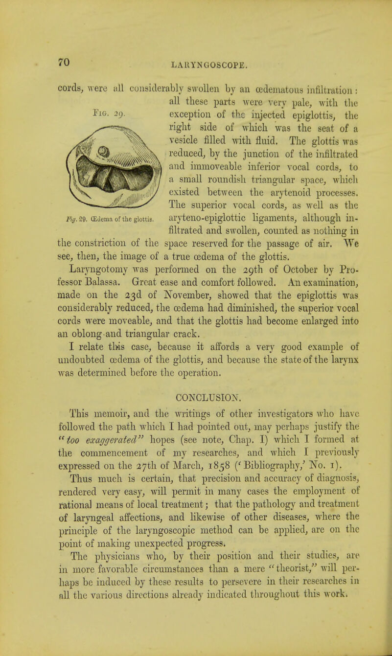 cords, were all considerably swollen by an oedeniutous infiltration : all these parts were very pale, with the -9- exception of the injected epiglottis, the right side of which was the seat of a vesicle filled with fluid. The glottis was reduced, by the junction of the infiltrated and immoveable inferior vocal cords, to a small roundish triaugnlar space, which existed between the arytenoid processes. The superior vocal cords, as well as the /ty. 29. (Edema of the glottis. aryteno-epiglottic ligaments, although in- filtrated and swollen, counted as nothing in the constriction of the space reserved for the passage of air. We see, then, the image of a true oedema of the glottis. Laryngotomy was performed on the 29th of October by Pro- fessor Balassa. Great ease and comfort followed. An examination, made on the 23d of November, showed that the epiglottis was considerably reduced, the oedema had diminished, the superior vocal cords were moveable, and that the glottis had become enlarged into an oblong and triangular crack. I relate this case, because it affords a very good example of undoubted oedema of the glottis, and because the state of the larynx was determined before the operation. CONCLUSION. This memoir, and the writings of other investigators who have followed the path which I had pointed out, may perhaps justify the too exaggerated hopes (see note, Chap. I) which I formed at the commencement of my researches, and which I previously expressed on the 27th of March, 1858 ('Bibliography/ No. 1). Thus much is certain, that precision and accuracy of diagnosis, rendered very easy, will permit in many cases the employment of rational means of local treatment; that the pathology and treatment of laryngeal affections, and likewise of other diseases, where the principle of the laryngoscopic method can be applied, are on the point of making unexpected progress. The physicians who, by their position and their studies, are in more favorable circumstances than a mere  theorist, will per- haps be induced by these results to persevere in their researches in all the various directions already indicated throughout this work.