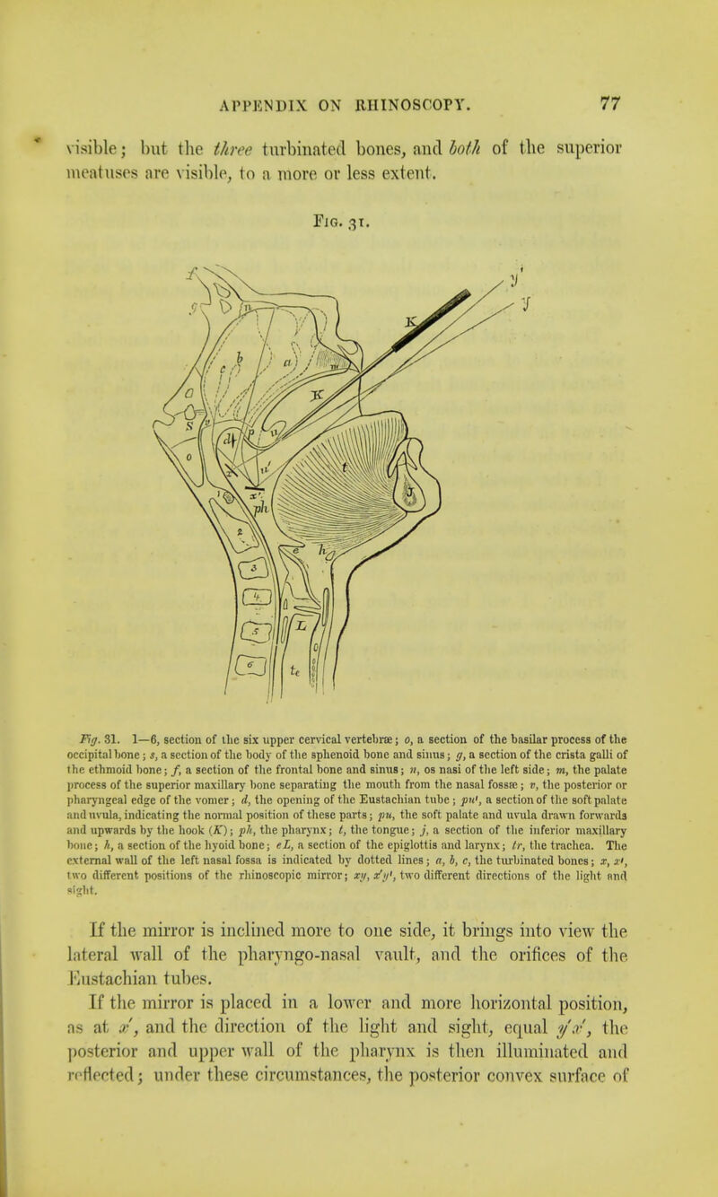visible; but the three turbinated bones, and both of the superior meatuses are visible, to a more or less extent. Fig. 31. Fig. 31. 1—6, section of the six upper cervical vertebrae; o, a section of the basilar process of the occipital hone; s, a section of the body of the sphenoid bone and sinus; g, a section of the crista galli of the ethmoid bone; /, a section of the frontal bone and sinus; n, os nasi of the left side; m, the palate process of the superior maxillary bone separating the mouth from the nasal fossa;; v, the posterior or pharyngeal edge of the vomer ; d, the opening of the Eustachian tube ; put, a section of the soft palate and uvula, indicating the normal position of these parts; pu, the soft palate and uvula drawn forwards and upwards by the hook (K); pit, the pharynx; t, the tongue; j, a section of the inferior maxillary bone; h, a section of the hyoid bone; eL, a section of the epiglottis and larynx; tr, the trachea. The rvternal wall of the left nasal fossa is indicated by dotted lines; a, b, c, the turbinated bones; x, x>, two different positions of the rhinoscopic mirror; x\j, x'tf, two different directions of the light and sight. If the mirror is inclined more to one side, it brings into view the lateral wall of the pharvngo-nasal vault, and the orifices of the Kustachian tubes. If the mirror is placed in a lower and more horizontal position, ii- at ./•', and the direction of the light and sight, equal //, the posterior and upper wall of the pharynx is then illuminated and reflected; under these circumstances, the posterior convex surface of