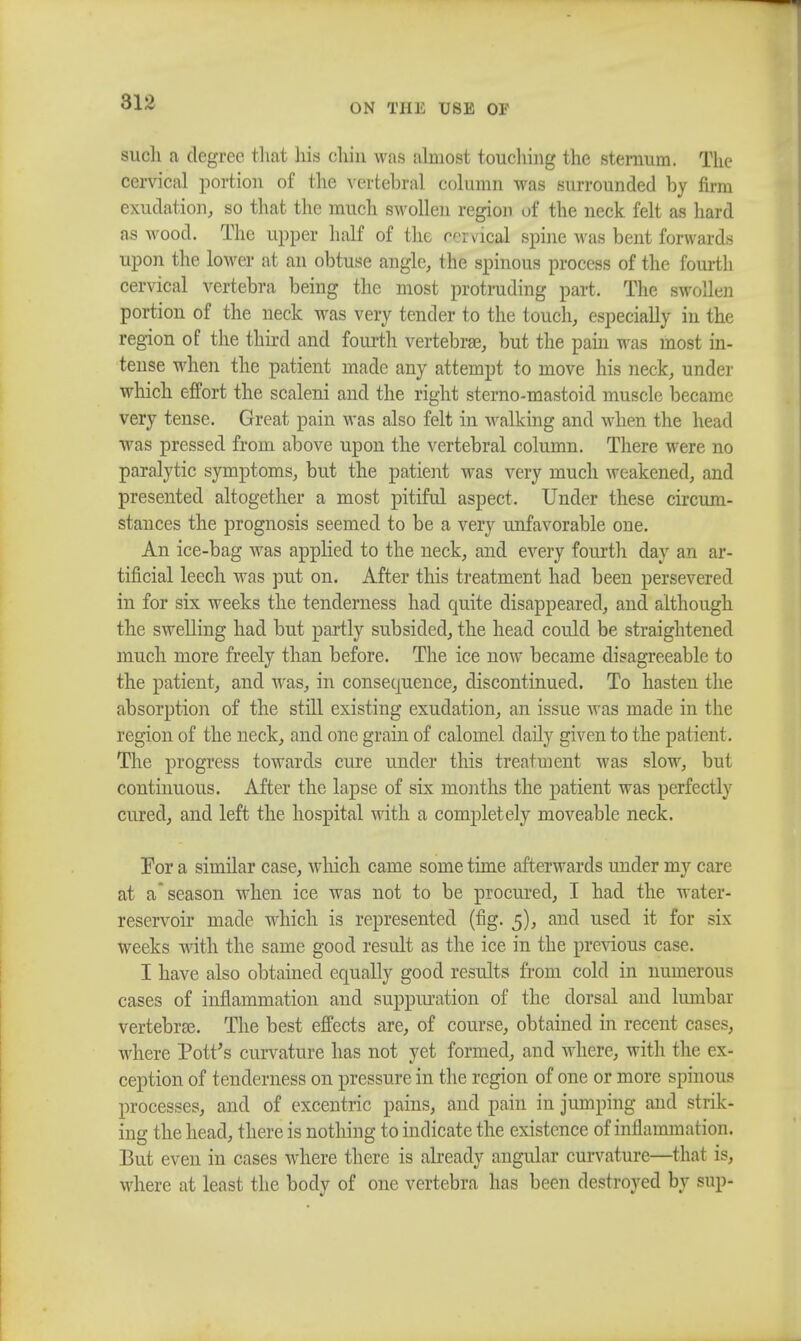 ON THE USE OF such a degree that his chin was almost touching the sternum. The cervical portion of the vertebral column was surrounded by firm exudation, so that the much swollen region of the neck felt as hard as wood. The upper half of the cemgal spine was bent forwards upon the lower at an obtuse angle, the spinous process of the fourth cervical vertebra being the most protruding part. The swollen portion of the neck was very tender to the touch, especially in the region of the third and fourth vertebras, but the pain was most in- tense when the patient made any attempt to move his neck, under which effort the scaleni and the right sterno-mastoid muscle became very tense. Great pain was also felt in walking and when the head was pressed from above upon the vertebral column. There were no paralytic symptoms, but the patient was very much weakened, and presented altogether a most pitiful aspect. Under these circum- stances the prognosis seemed to be a very imfavorable one. An ice-bag was applied to the neck, and every fourth day an ar- tificial leech was put on. After this treatment had been persevered in for six weeks the tenderness had quite disappeared, and although the swelling had but partly subsided, the head could be straightened much more freely than before. The ice now became disagreeable to the patient, and was, in consequence, discontinued. To hasten the absorption of the still existing exudation, an issue Avas made in the region of the neck, and one grain of calomel daily given to the patient. The progress towards cure under this treatment was slow, but continuous. After the lapse of six months the patient was perfectly cured, and left the hospital with a completely moveable neck. Tor a similar case, which came some time afterwards under my care at a season when ice was not to be procured, I had the water- reservoir made which is represented (fig. 5), and used it for six weeks with the same good result as the ice in the previous case. I have also obtained equally good results from cold in numerous cases of inflammation and suppuration of the dorsal aud lumbar vertebras. The best effects are, of course, obtained in recent cases, where Pott's curvature has not yet formed, and where, with the ex- ception of tenderness on pressure in the region of one or more spinous processes, and of excentric pains, and pain in jumping and strik- ing the head, there is nothing to indicate the existence of inflammation. But even in cases where there is already angular curvature—that is, where at least the body of one vertebra has been destroyed by sup-